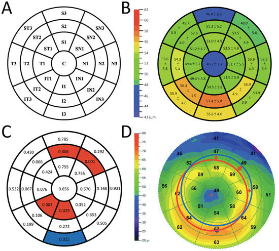 Efficacy of Myopia Control and Distribution of Corneal
