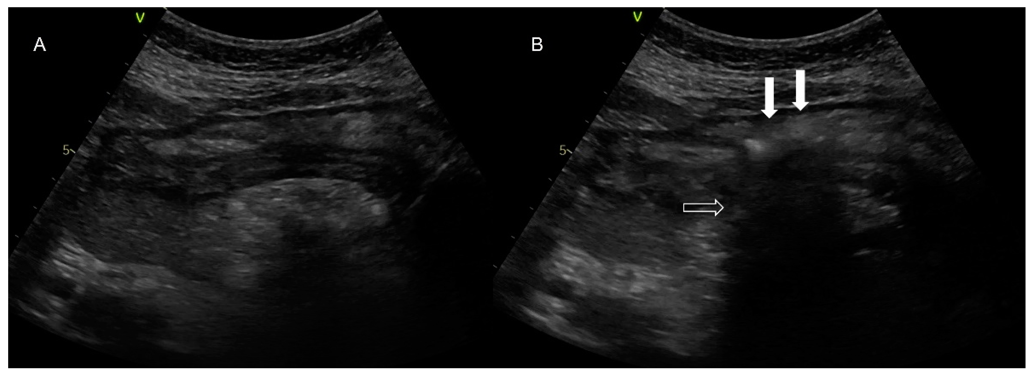 Jpm 12 00337 g004 550