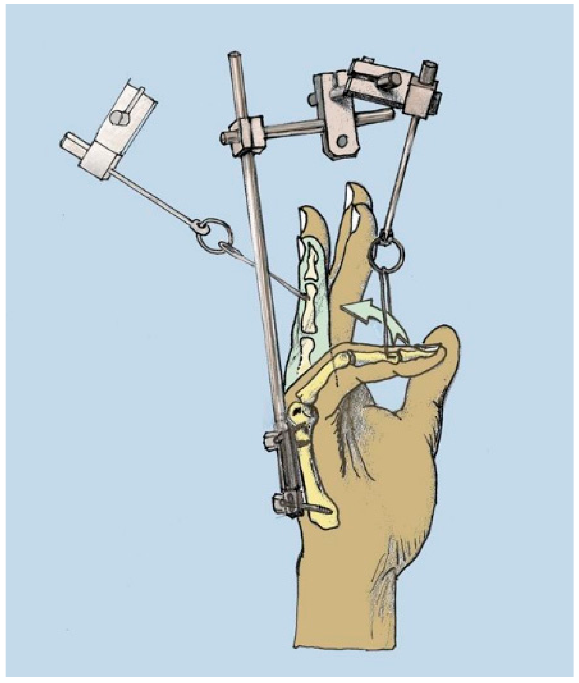 Jpm 12 00378 g001 550