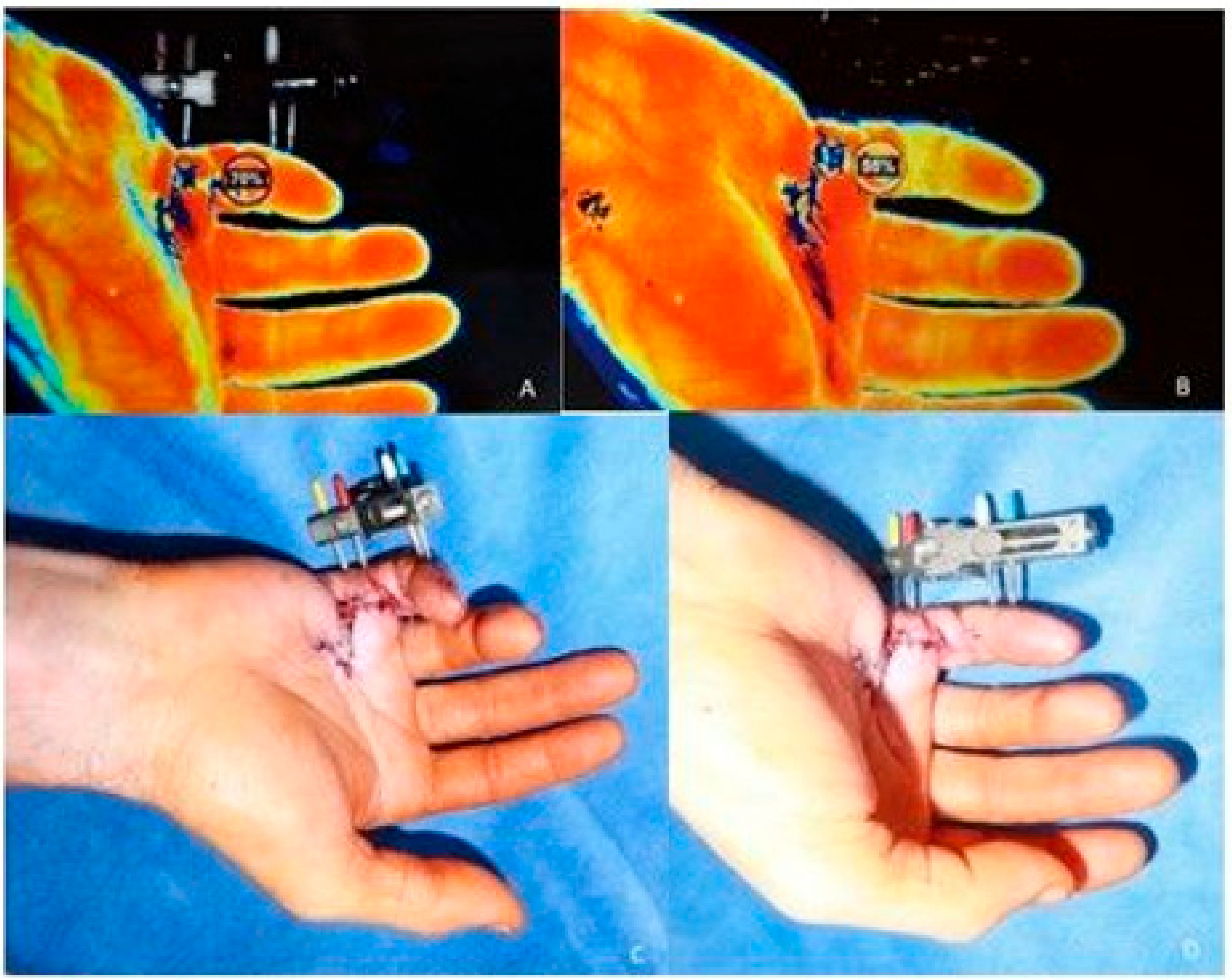 Jpm 12 00378 g003 550