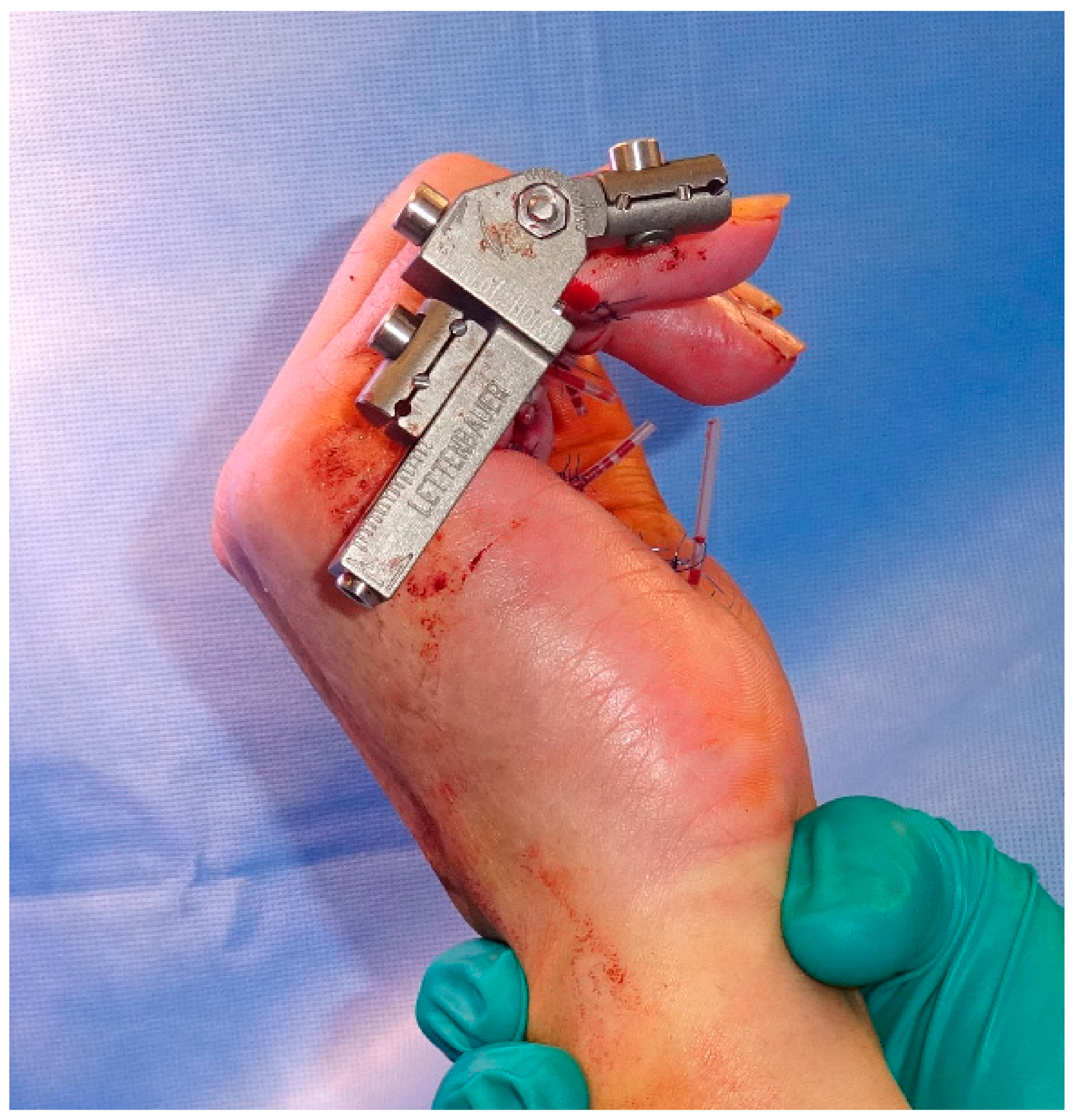 Jpm 12 00378 g007 550