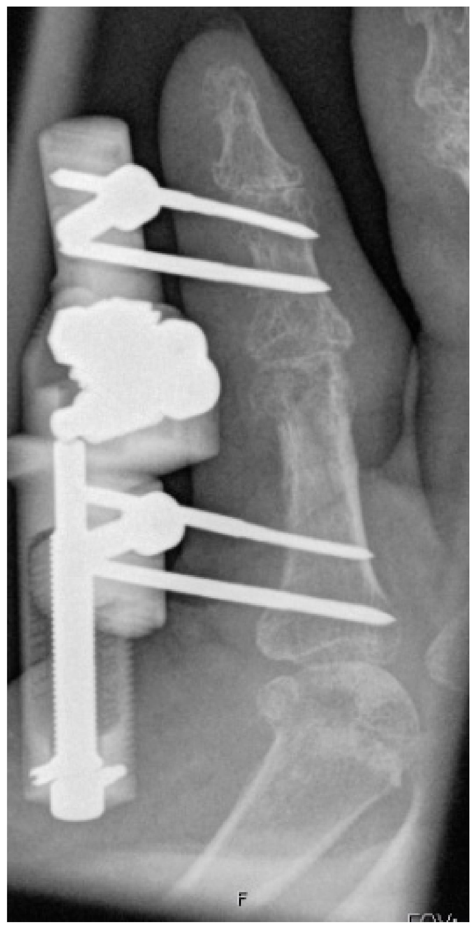 Jpm 12 00378 g008 550