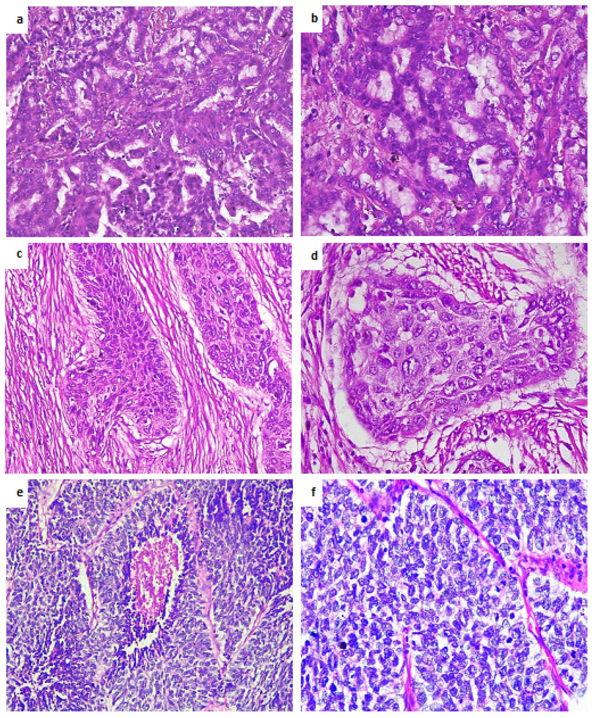 Jpm 12 00453 g004 550
