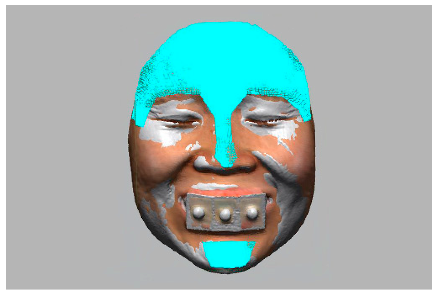 Jpm 12 00490 g005 550