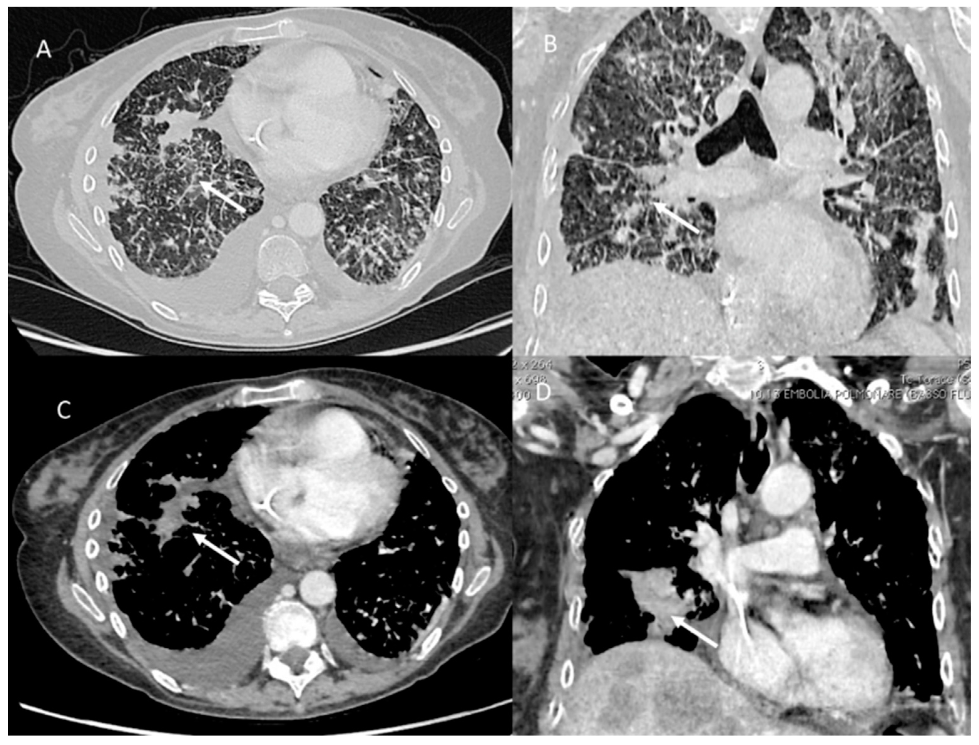 Jpm 12 00624 g001 Jpm 12 00624 g001