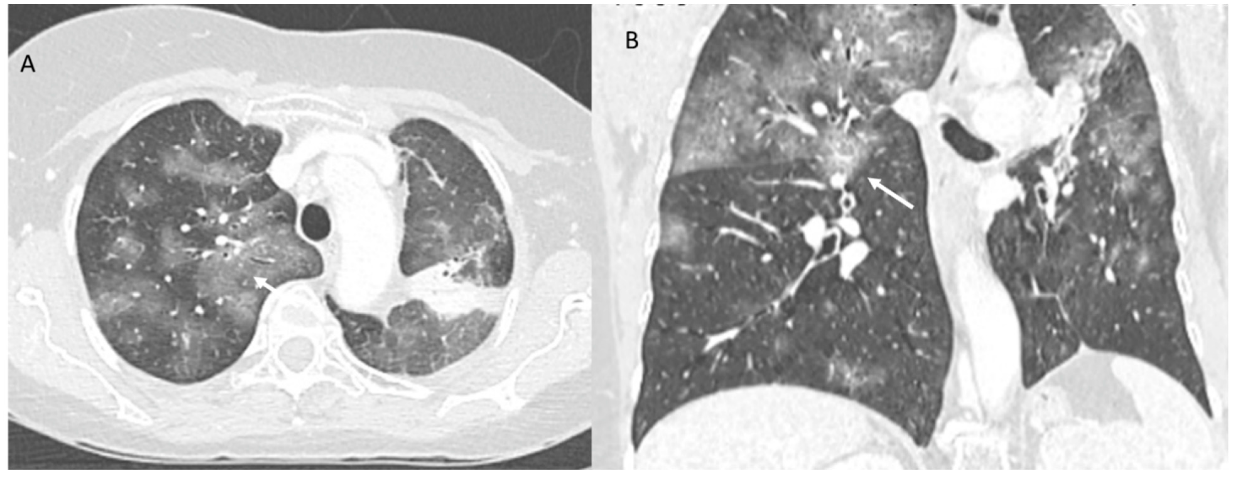 Jpm 12 00624 g003 Jpm 12 00624 g003