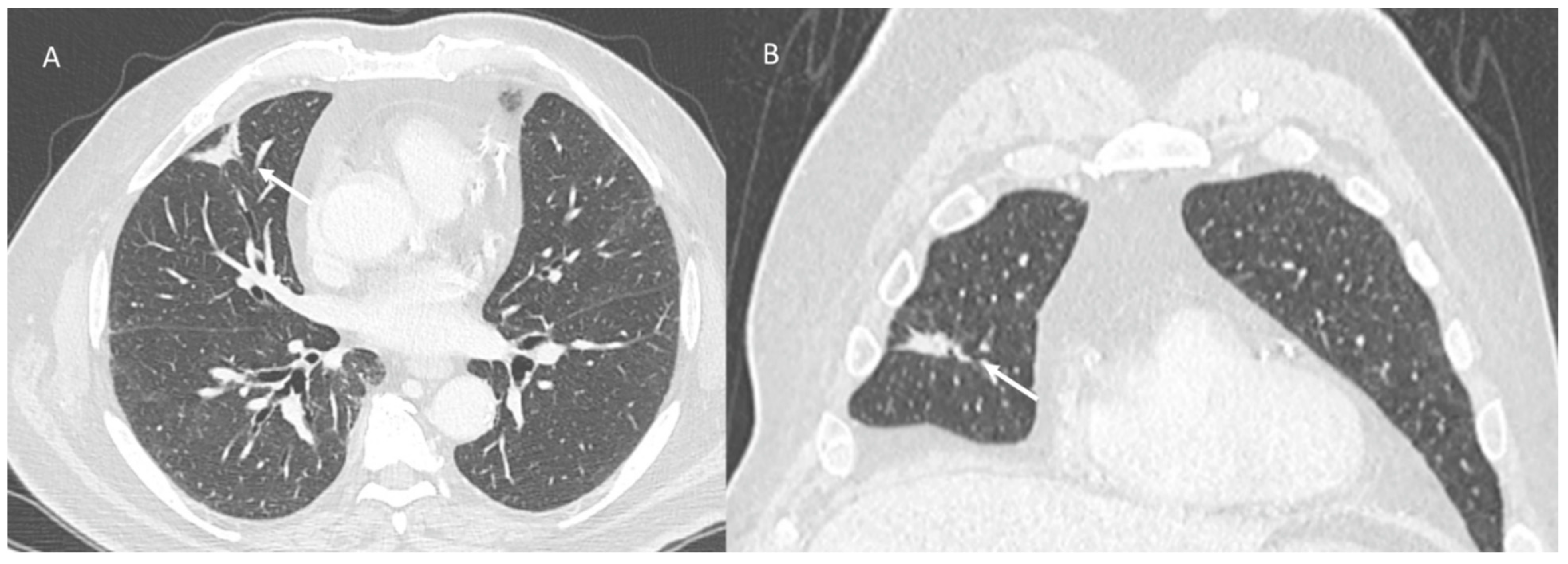 Jpm 12 00624 g004 Jpm 12 00624 g004