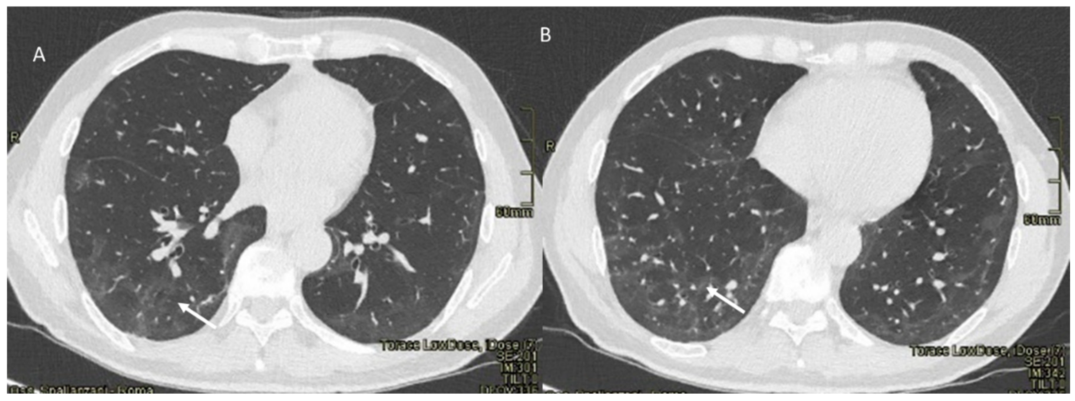 Jpm 12 00624 g005 Jpm 12 00624 g005