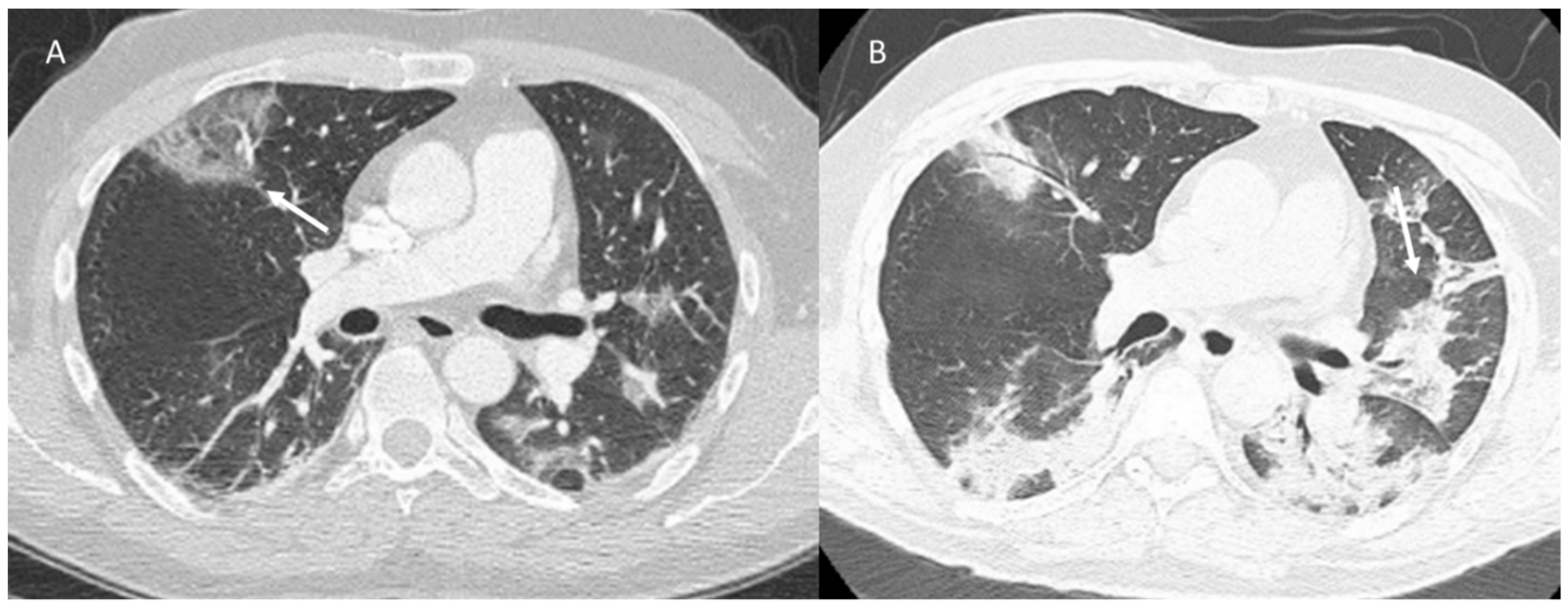 Jpm 12 00624 g006 Jpm 12 00624 g006