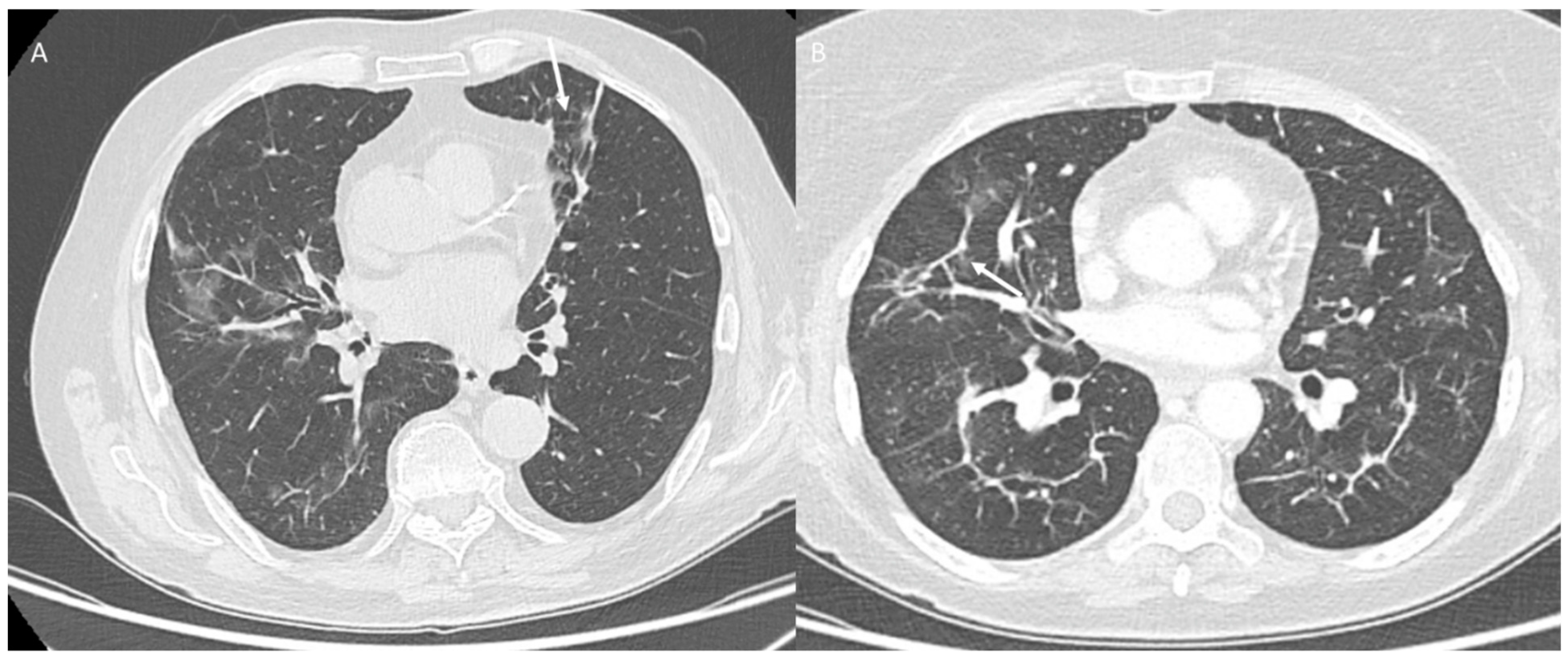 Jpm 12 00624 g007 Jpm 12 00624 g007