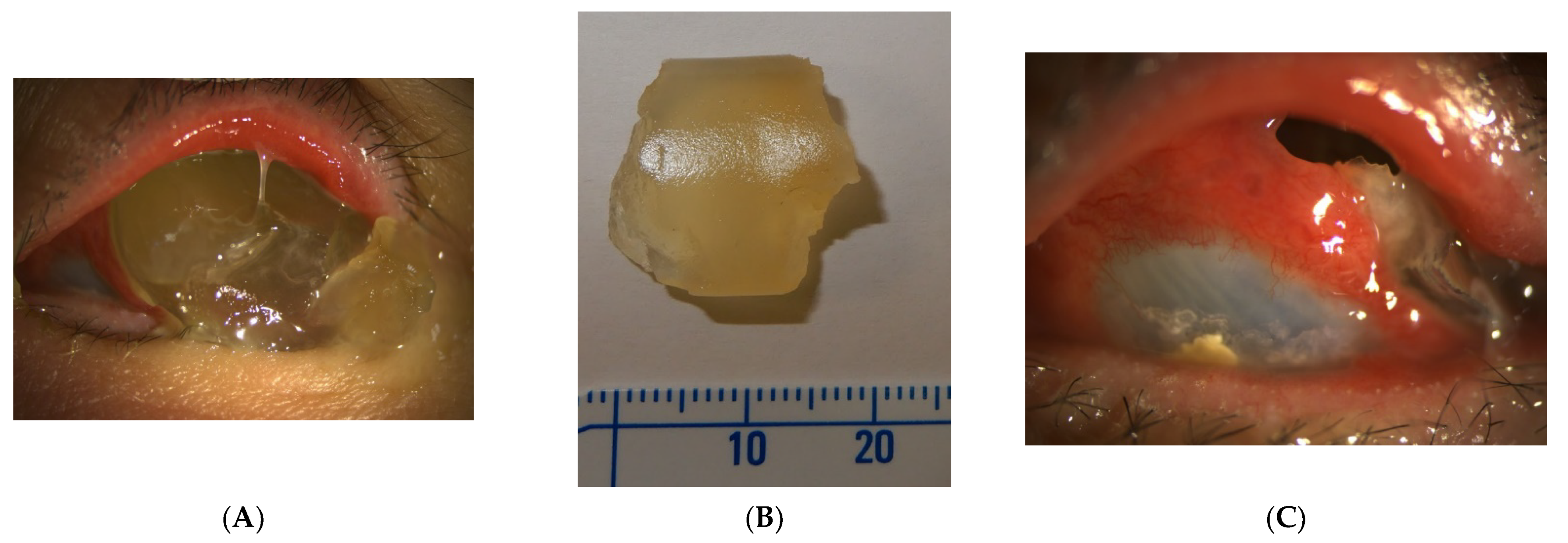 Jpm 12 00629 g001 550