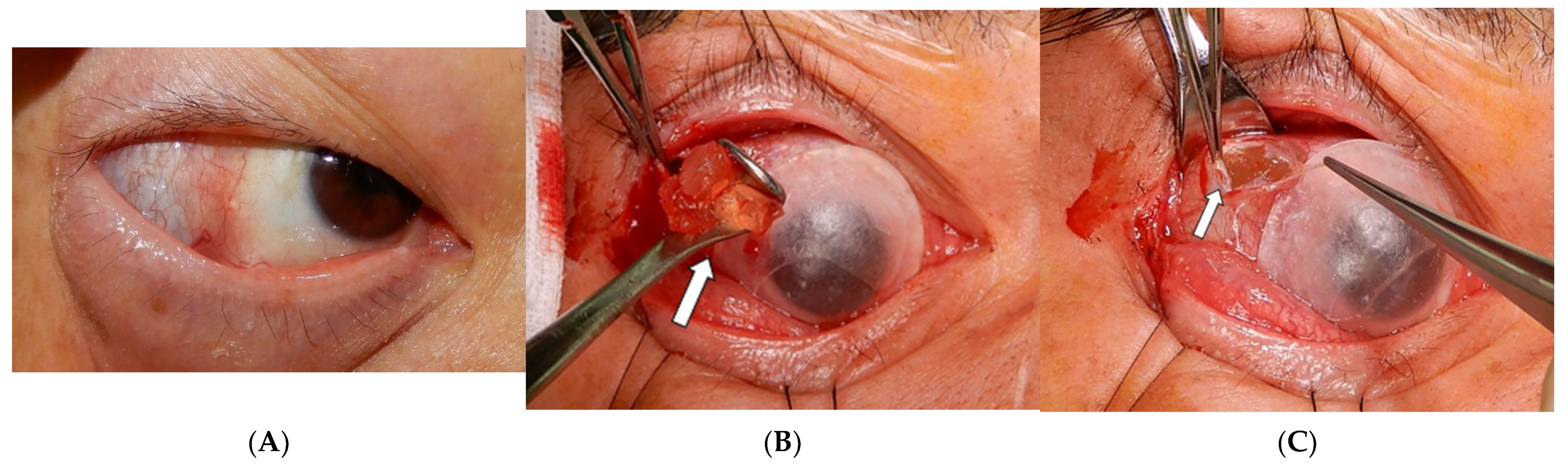 Jpm 12 00629 g006 550