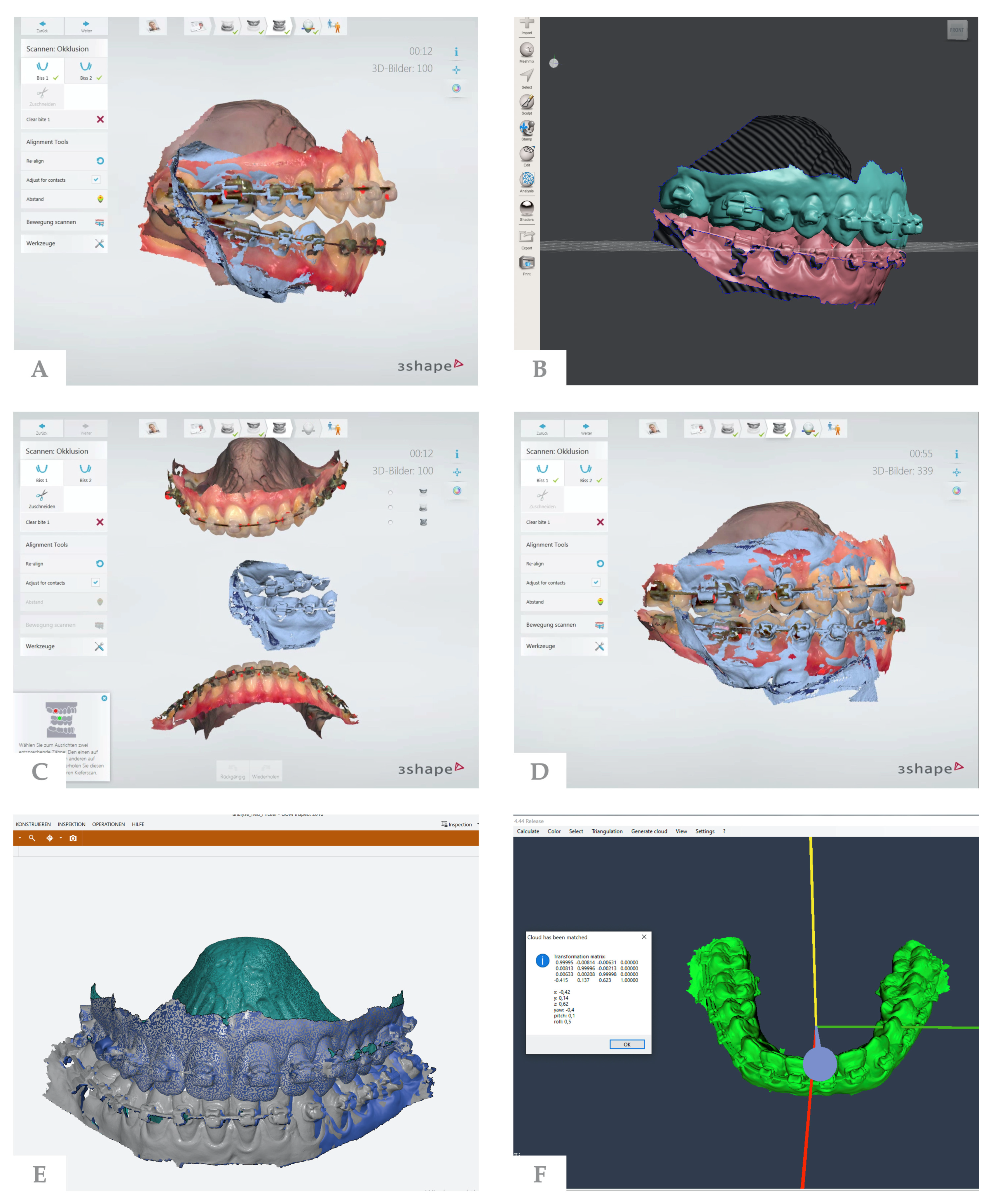 Jpm 12 00843 g001 550