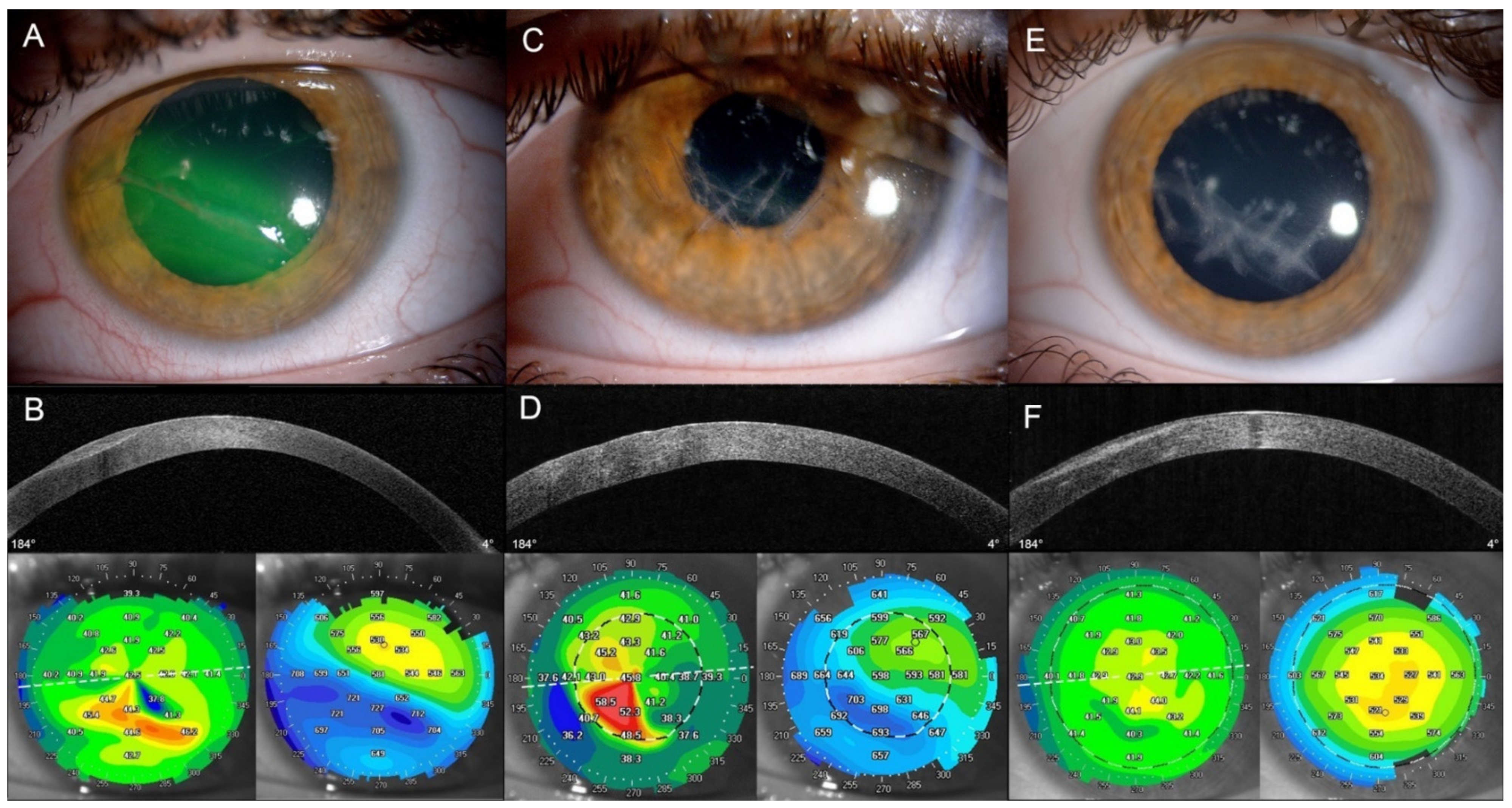 Jpm 12 00866 g001 Jpm 12 00866 g001