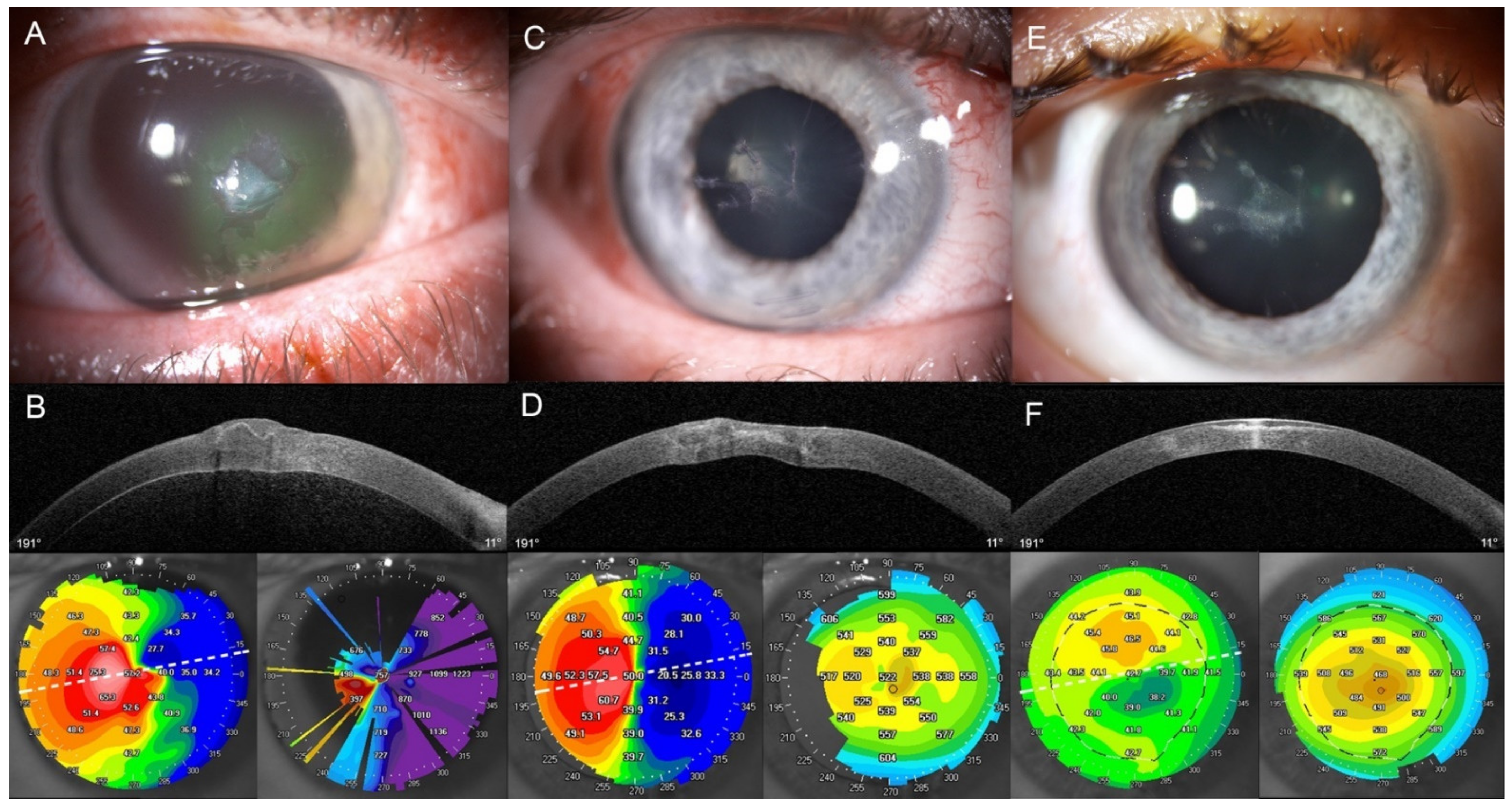 Jpm 12 00866 g002 Jpm 12 00866 g002