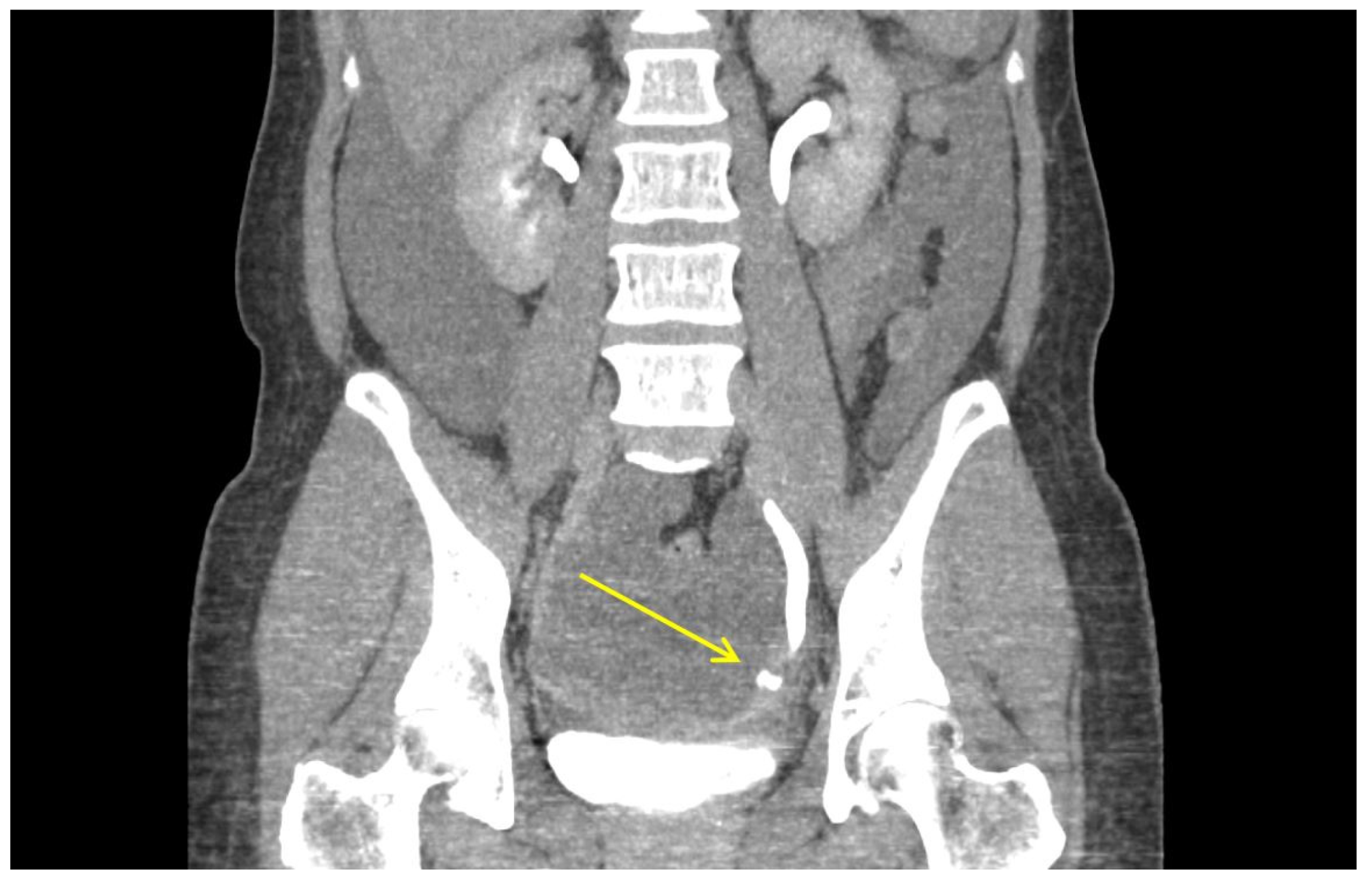 Jpm 12 00875 g002 550