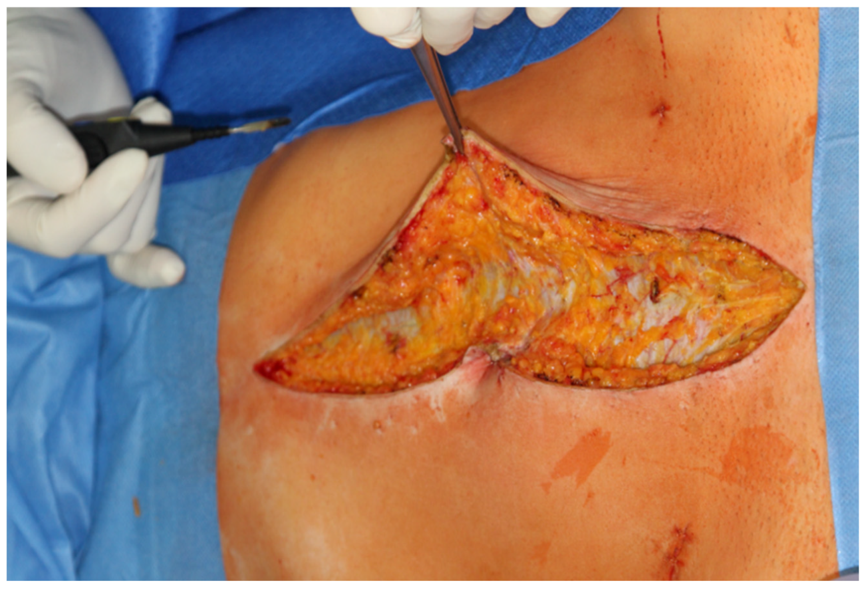 Jpm 12 00899 g001 550