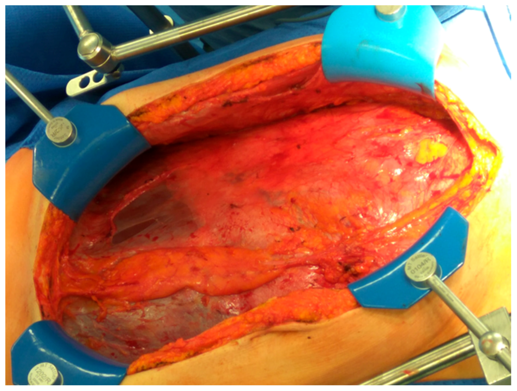 Jpm 12 00899 g004 550