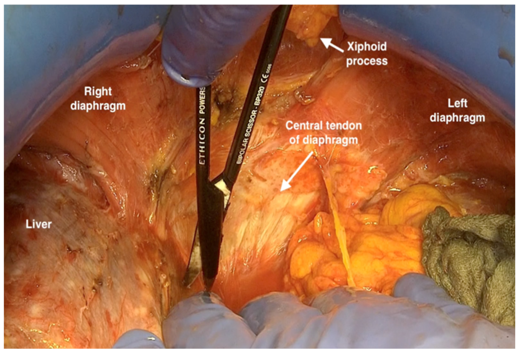 Jpm 12 00899 g005 550
