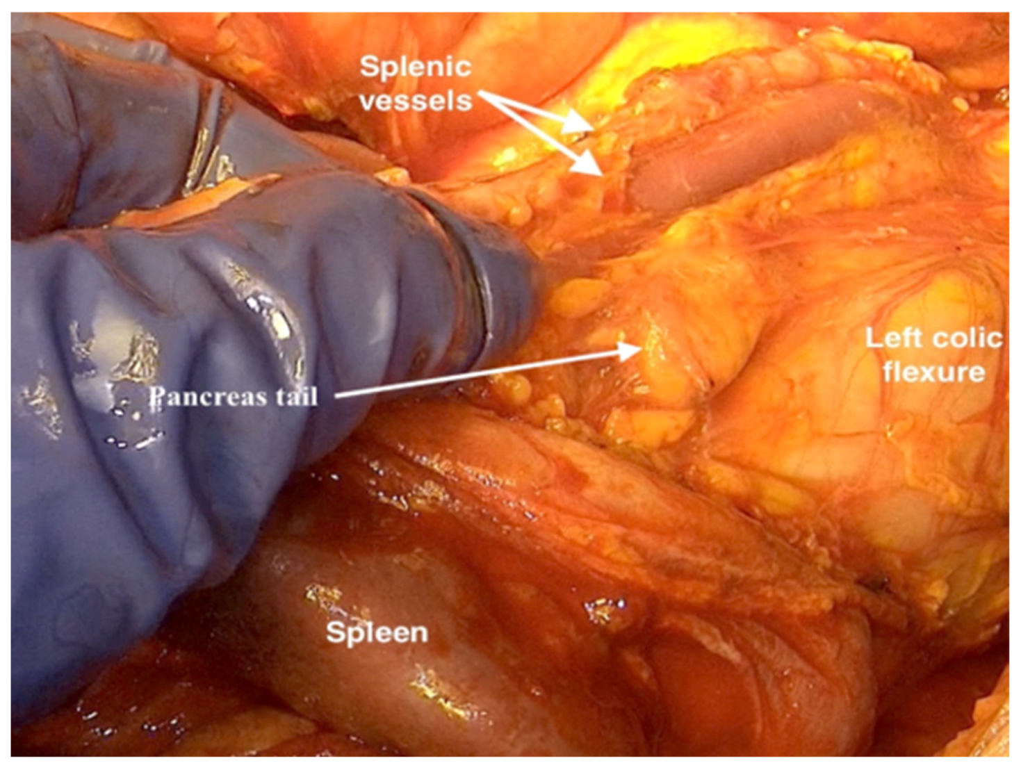 Jpm 12 00899 g010 550