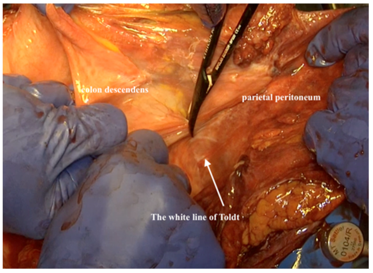 Jpm 12 00899 g011 550