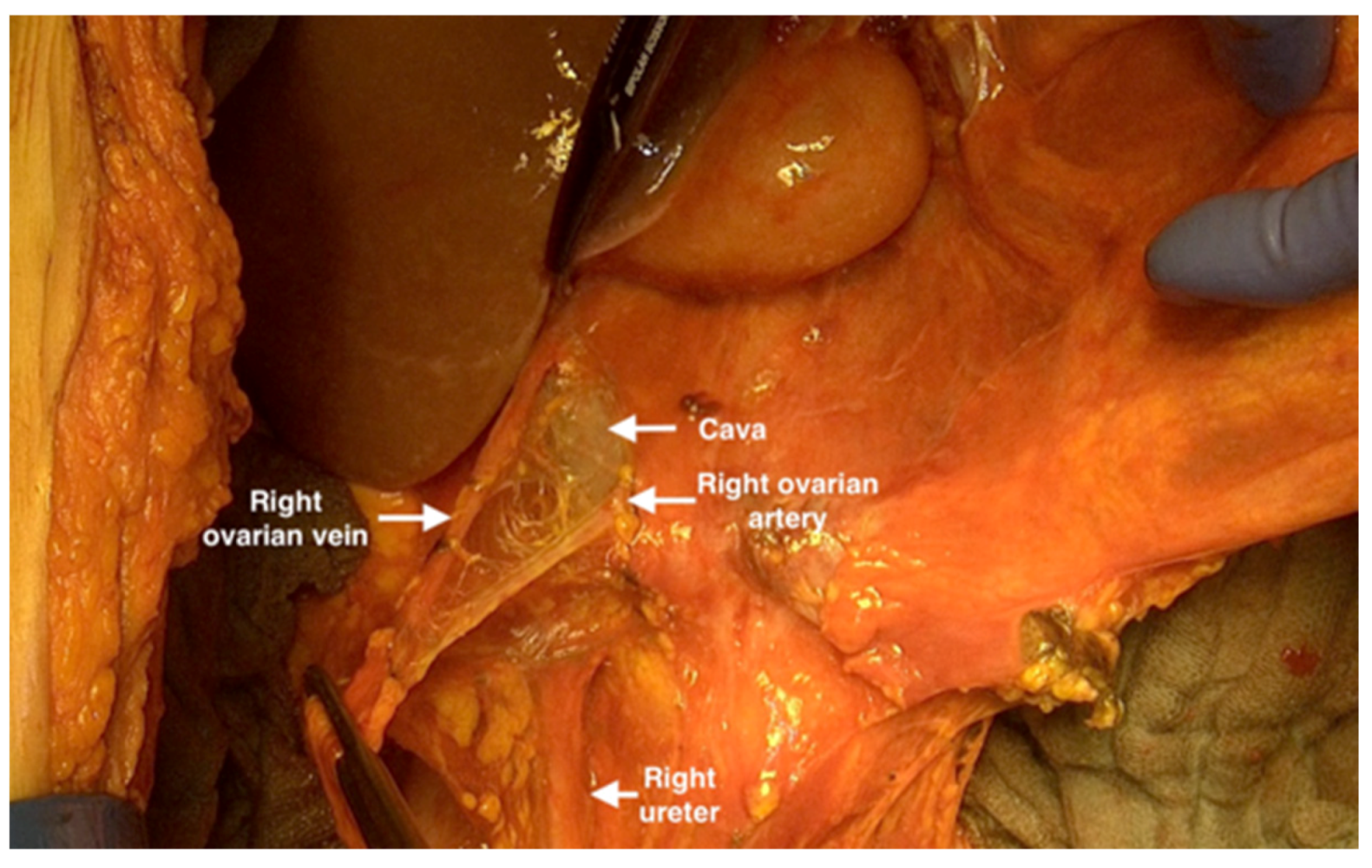 Jpm 12 00899 g012 550