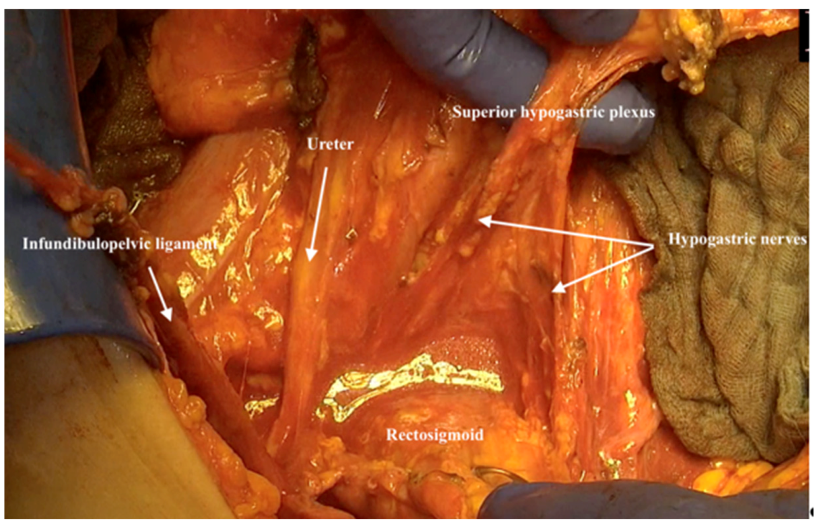 Jpm 12 00899 g013 550