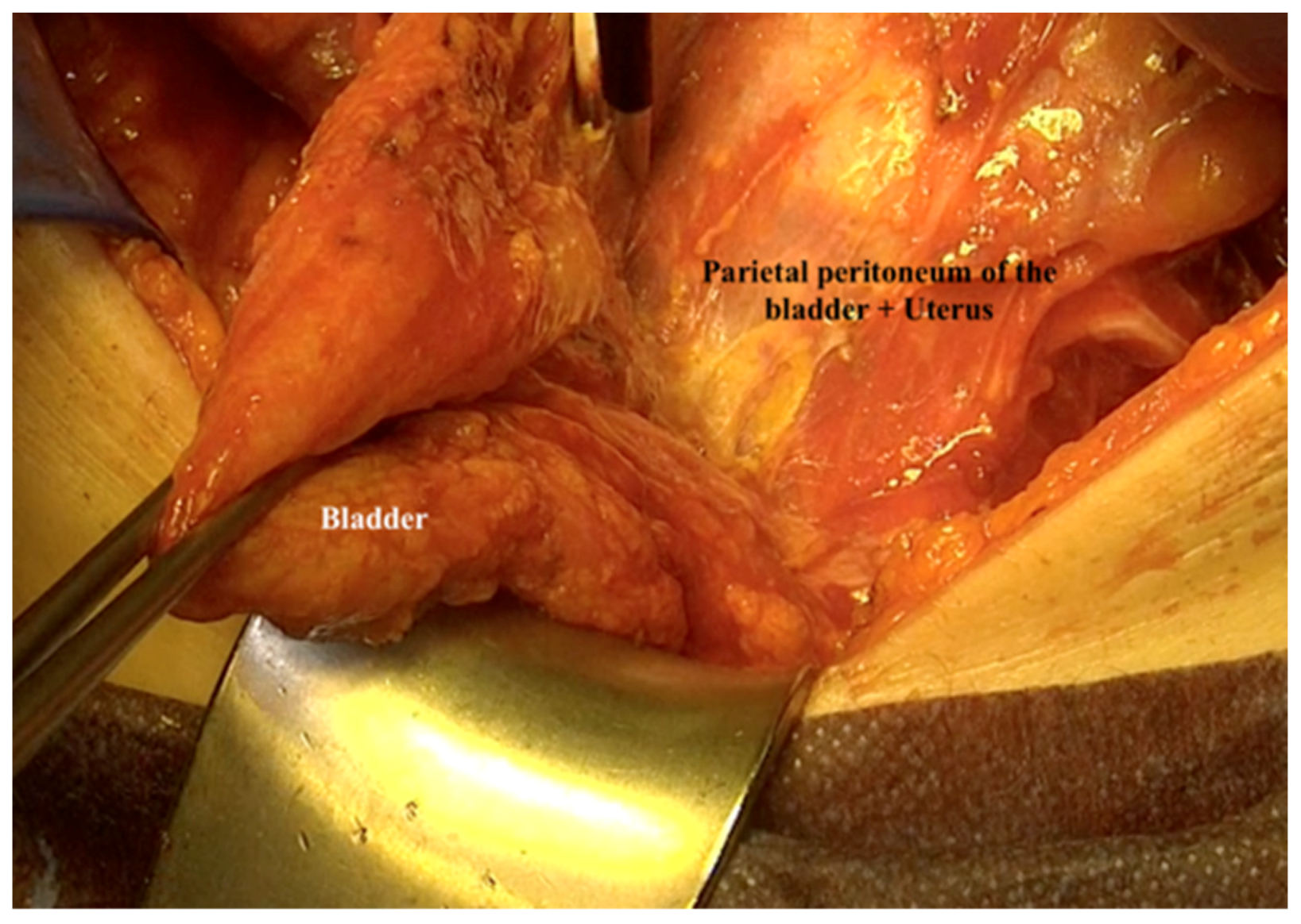 Jpm 12 00899 g015 550