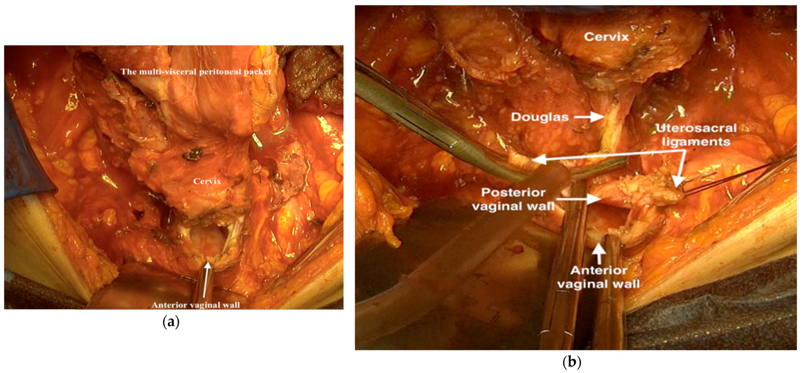 Jpm 12 00899 g017 550