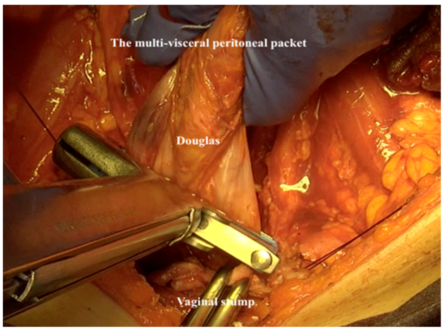 Jpm 12 00899 g019 550