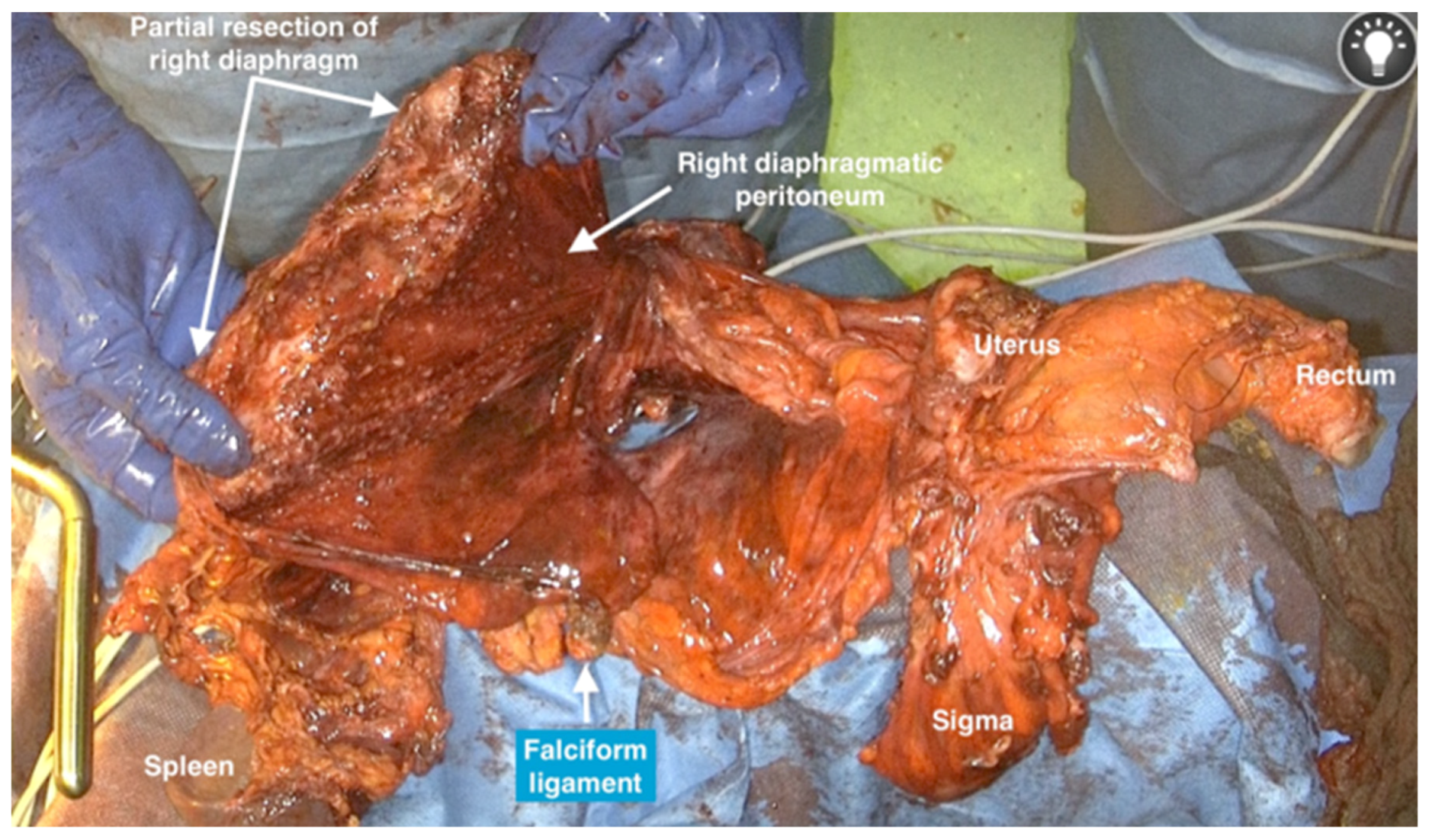 Jpm 12 00899 g020 550