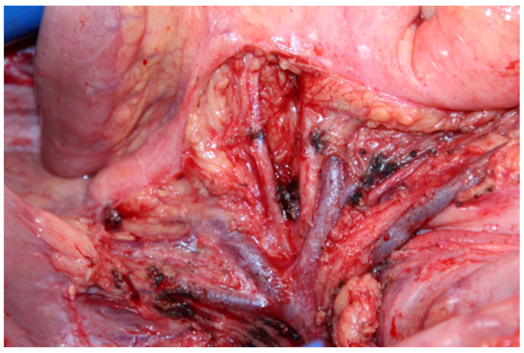 Jpm 12 00899 g021 550