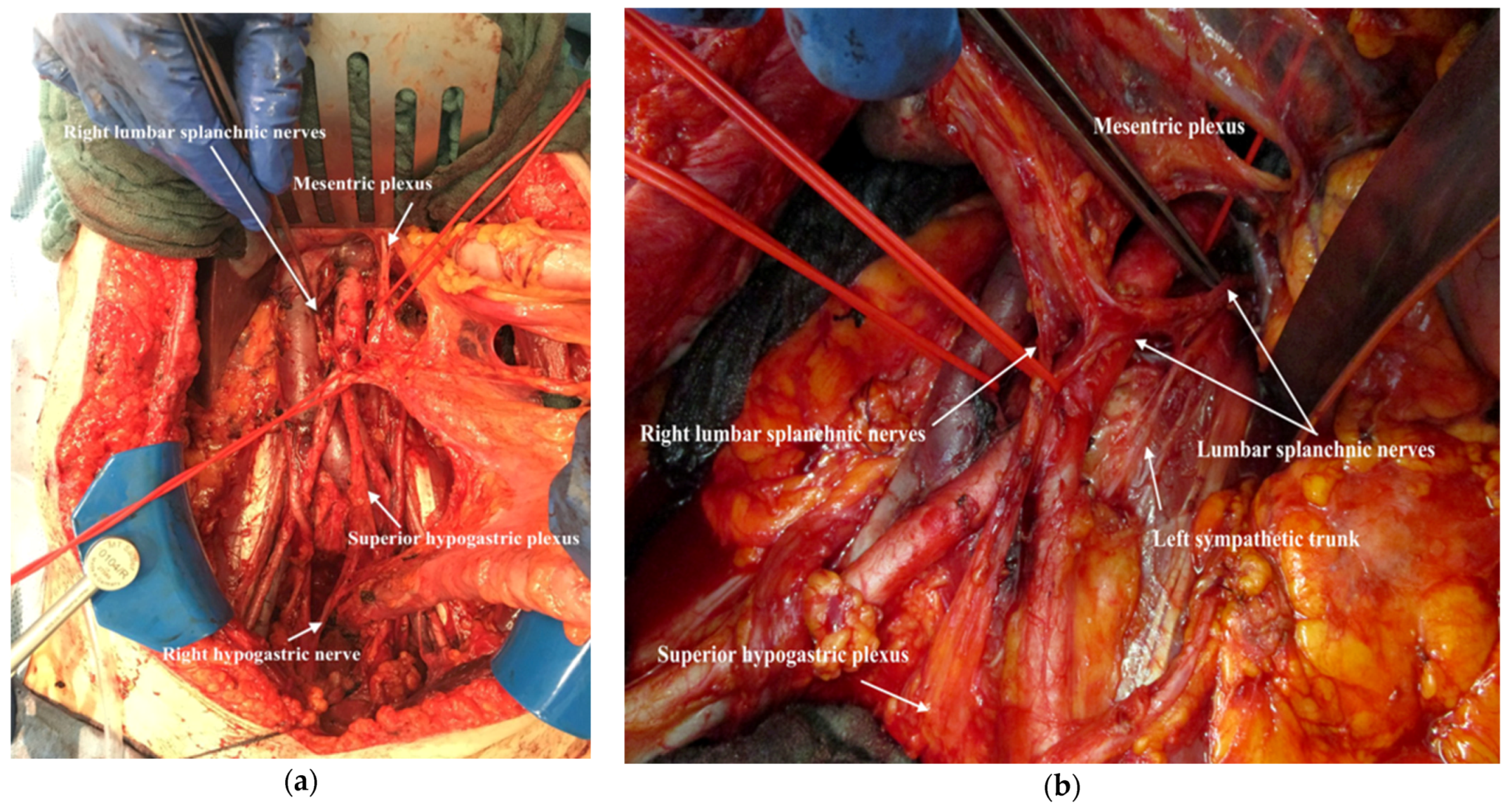 Jpm 12 00899 g022 550