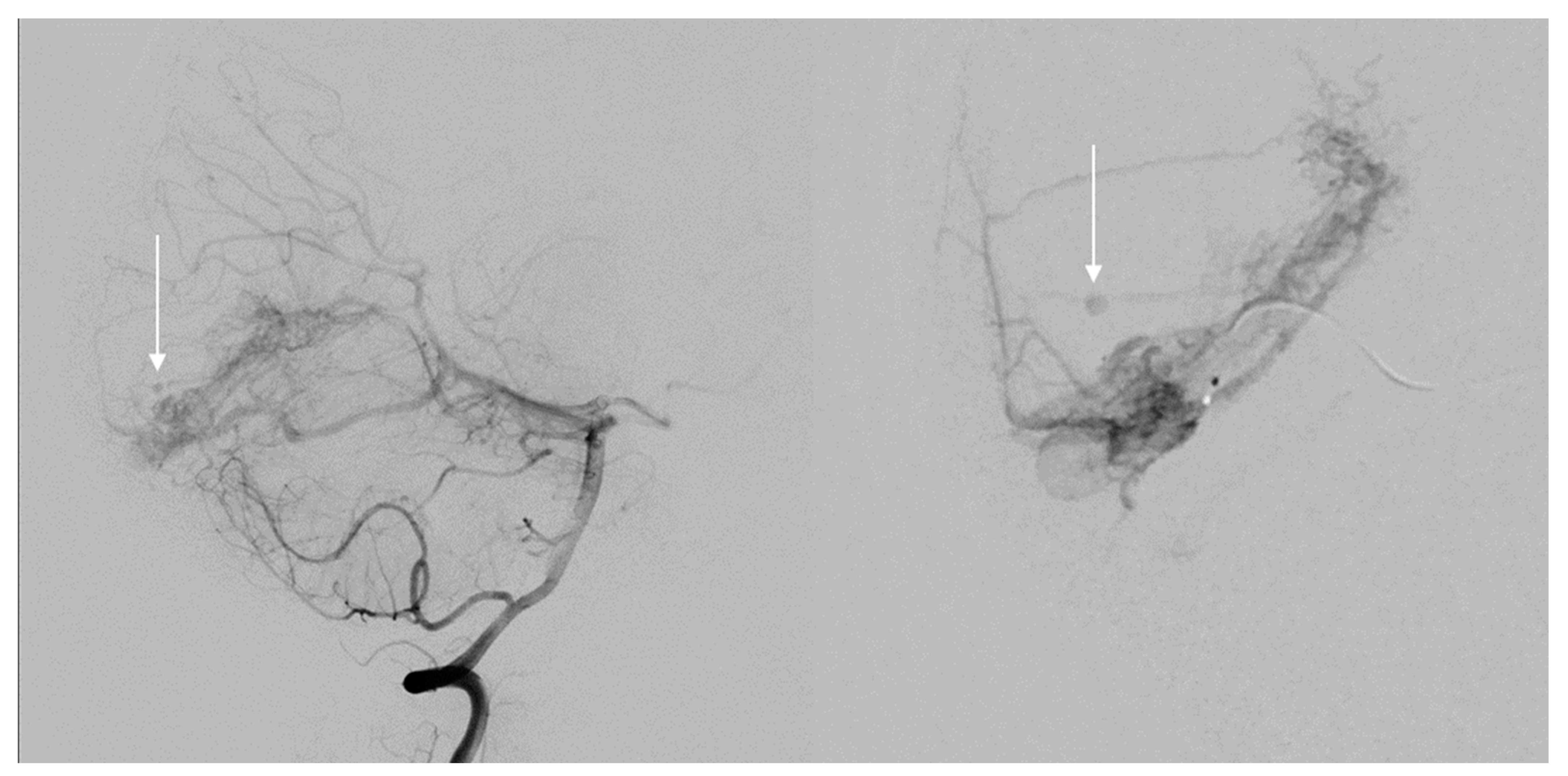 Jpm 12 00904 g001 550