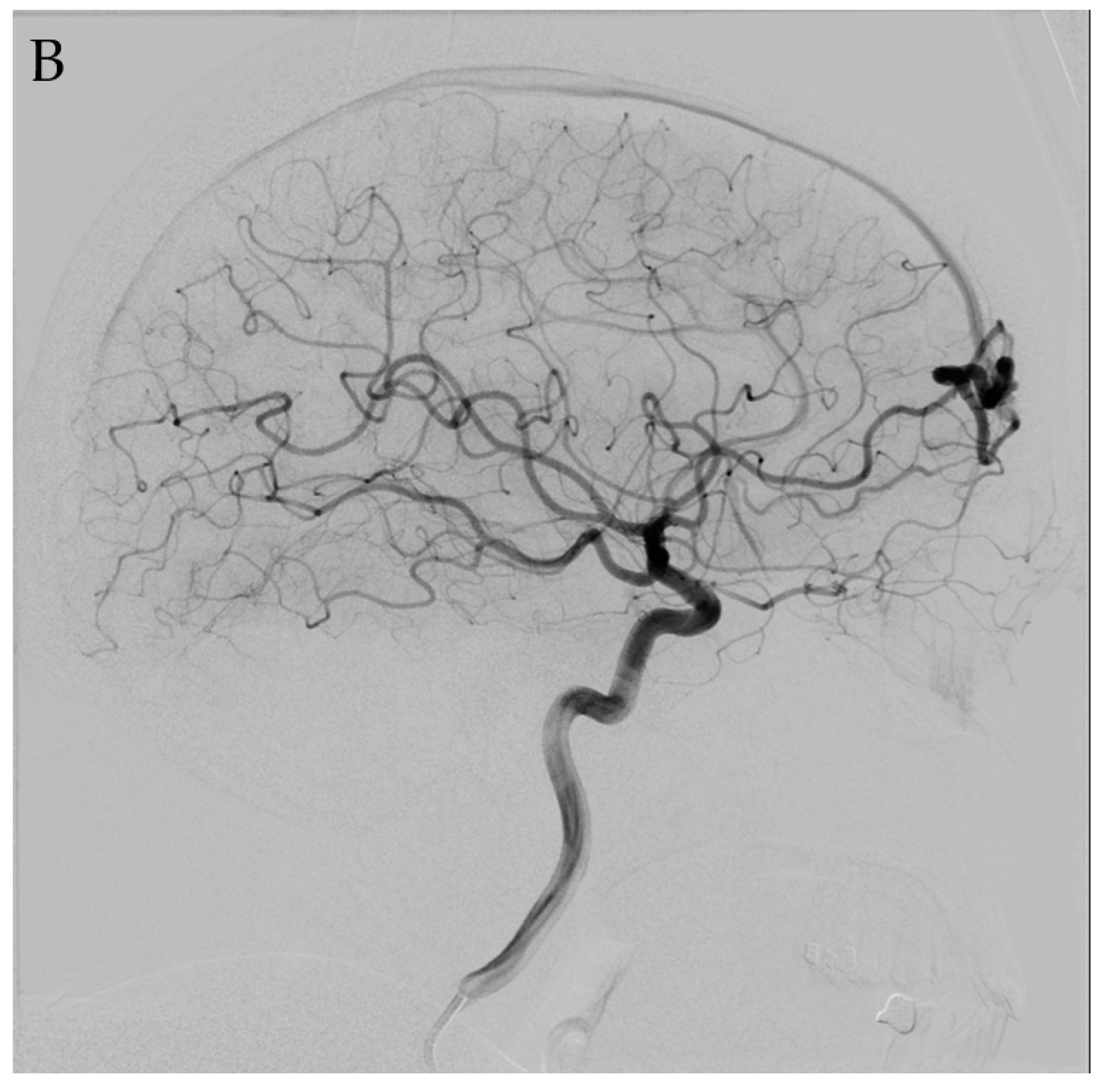 Jpm 12 00904 g002b 550