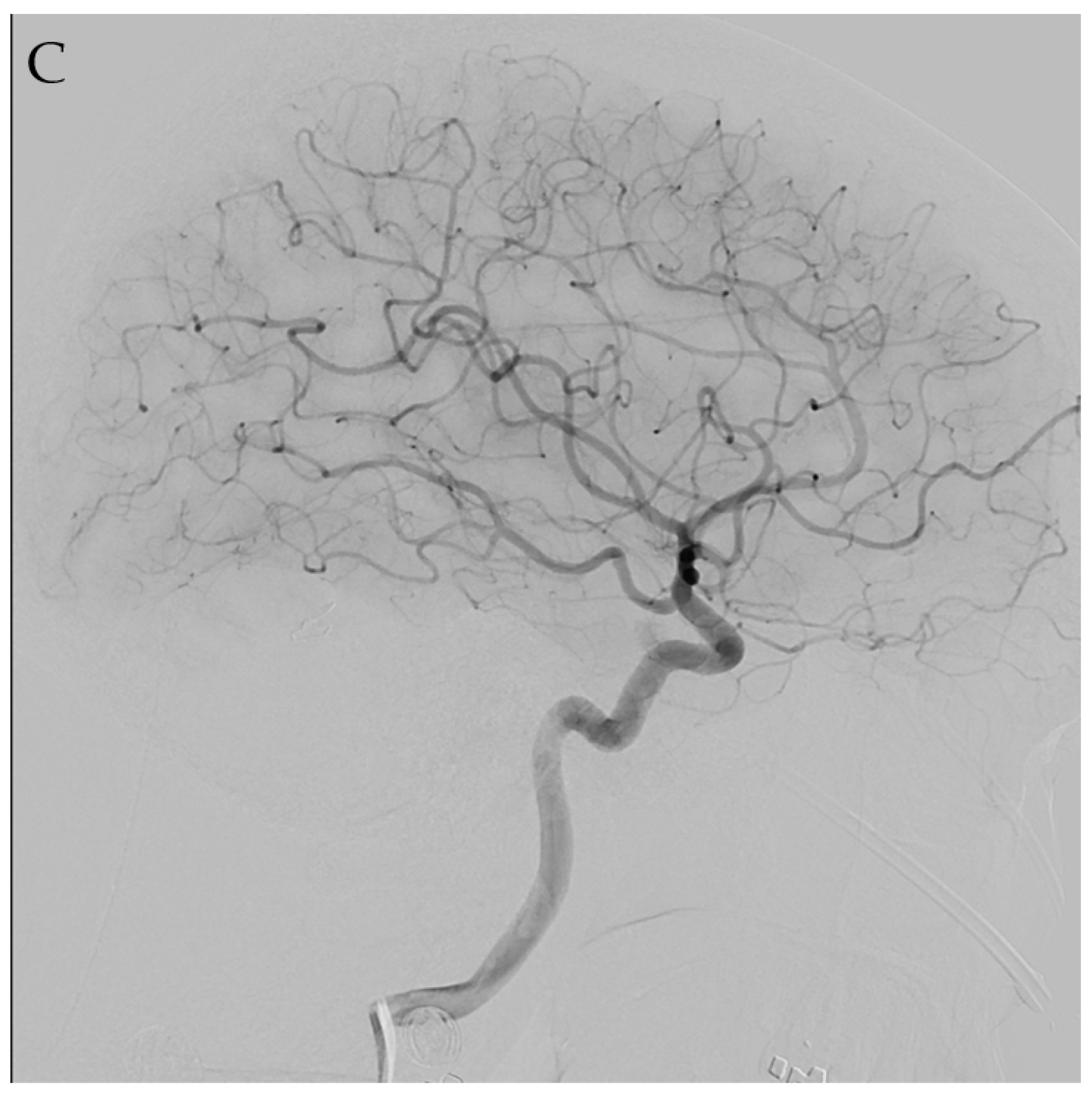 Jpm 12 00904 g002c 550