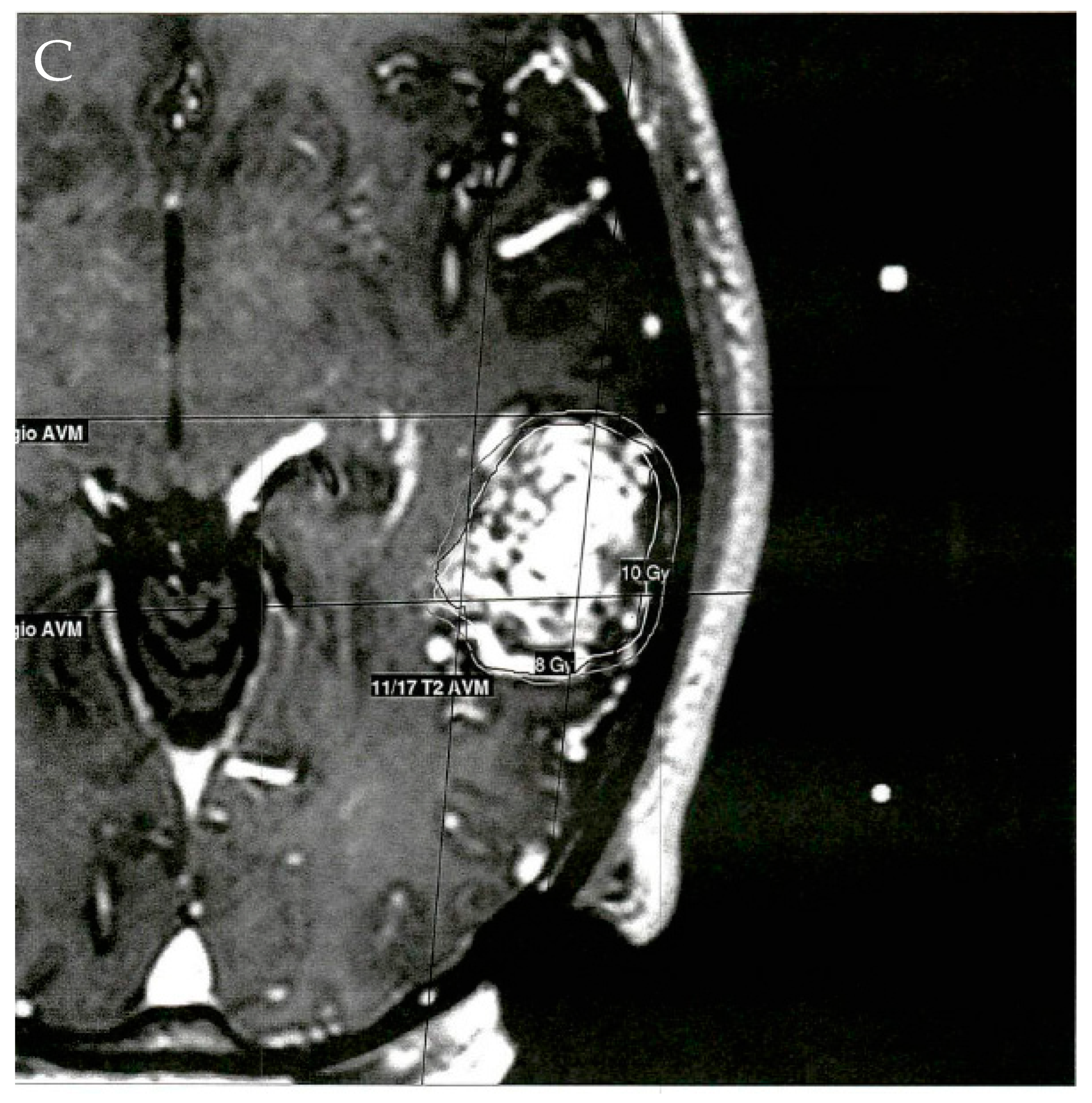 Jpm 12 00904 g003c 550