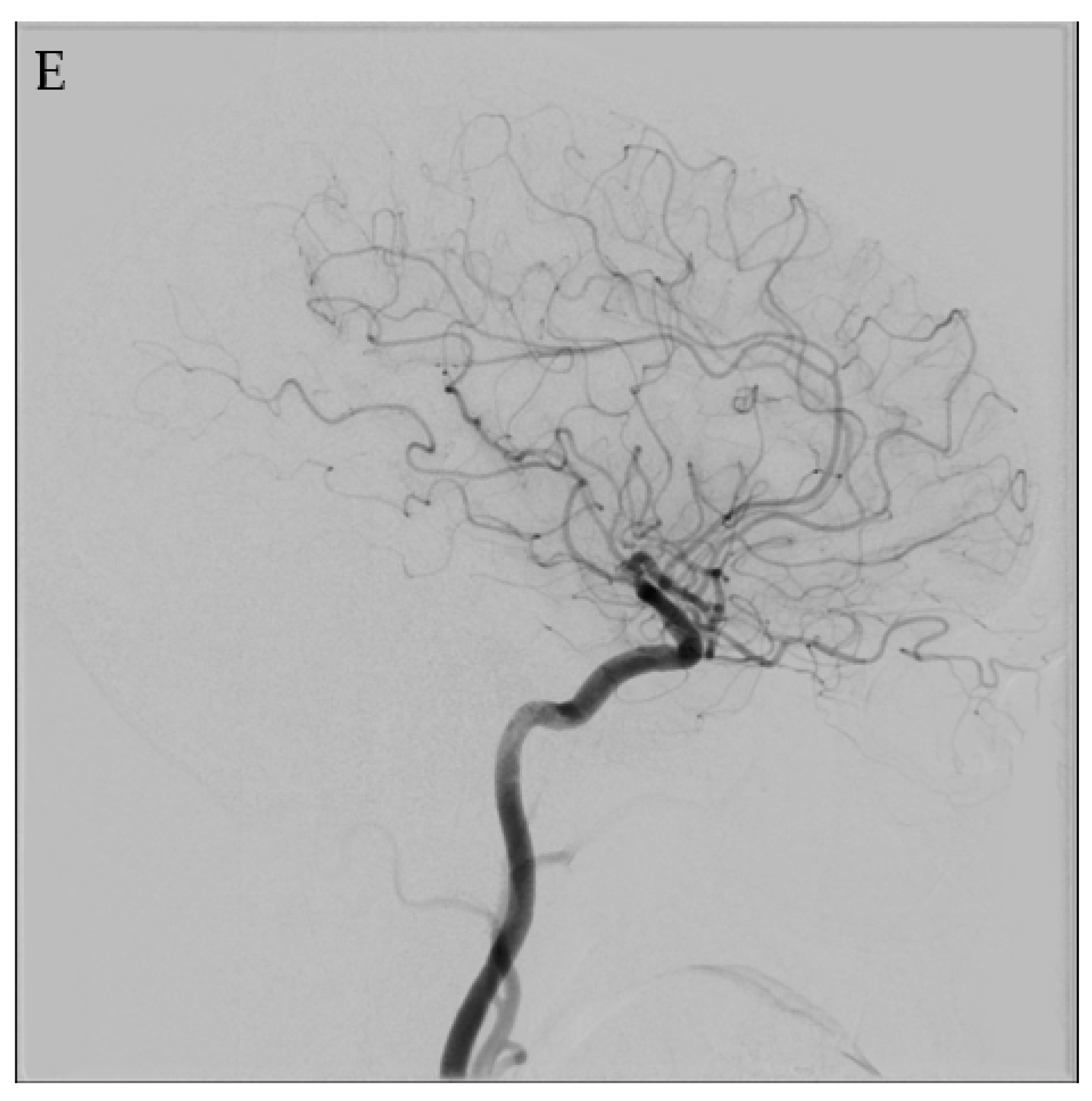 Jpm 12 00904 g003e 550