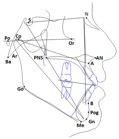 Complex Systems and Artificial Intelligence