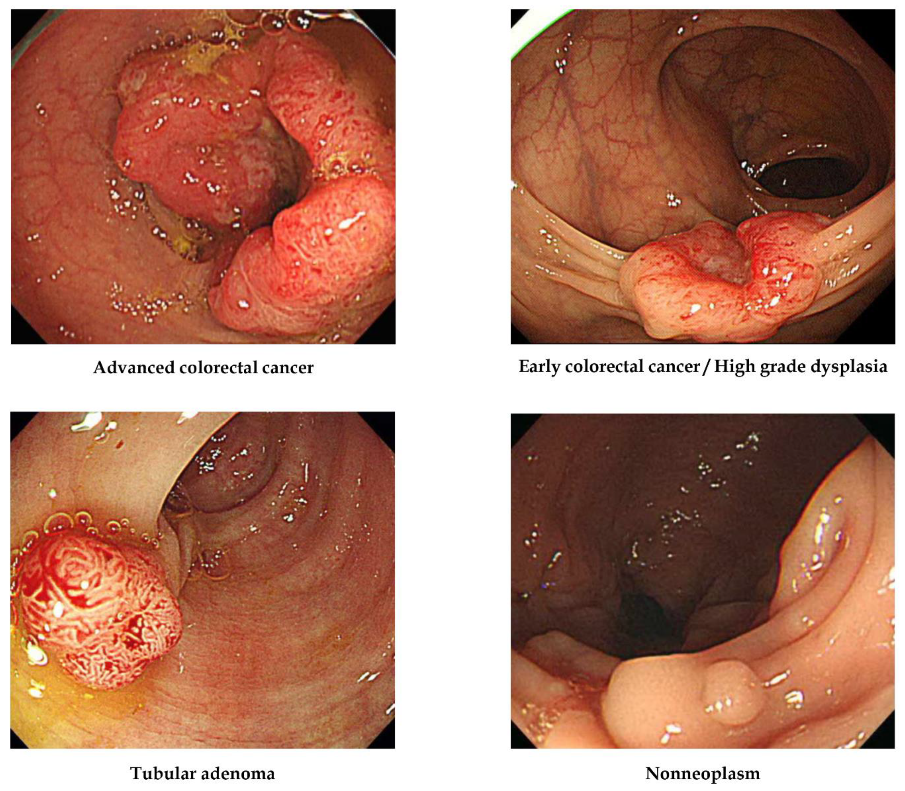 Jpm 12 00963 g001 550