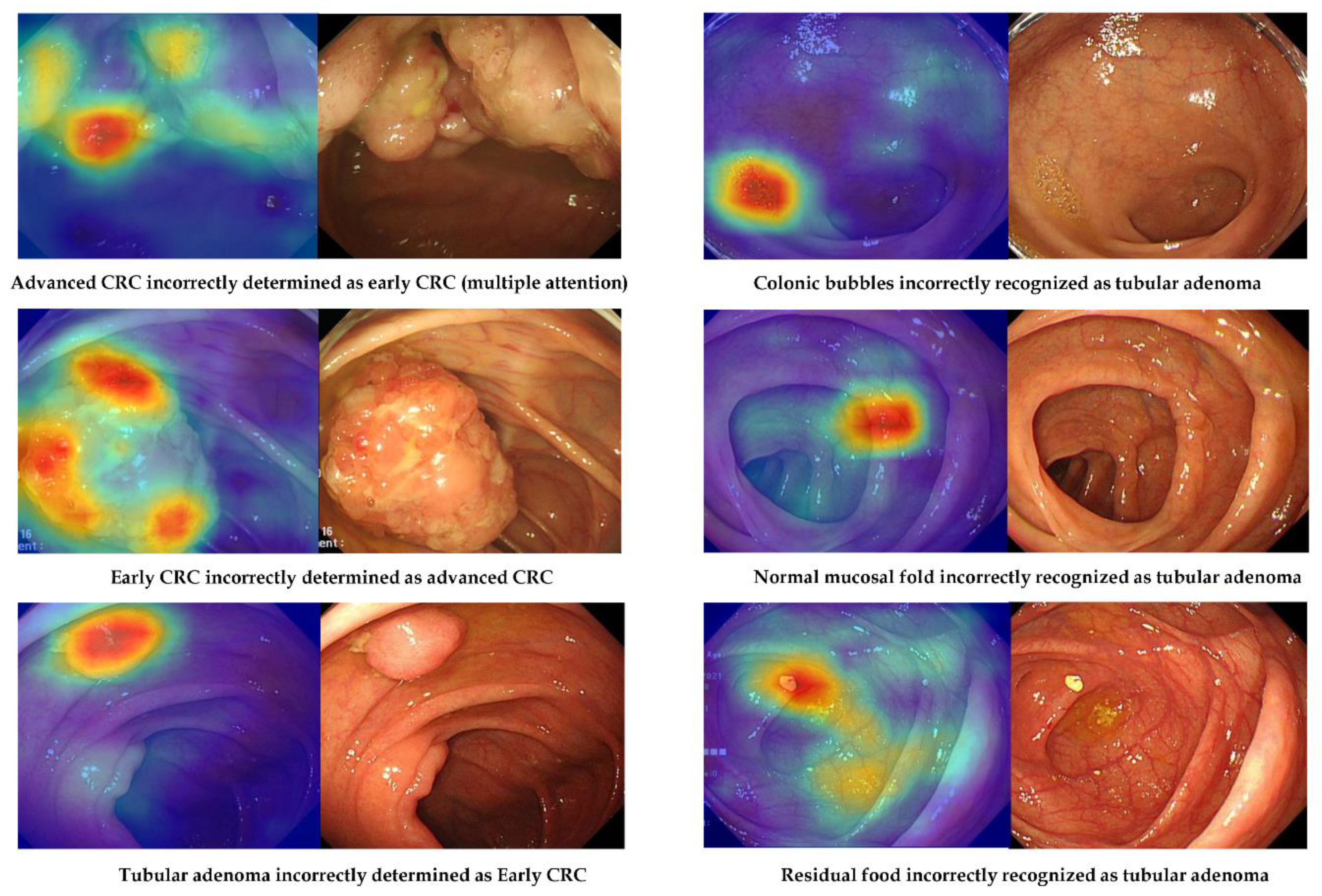Jpm 12 00963 g004 550