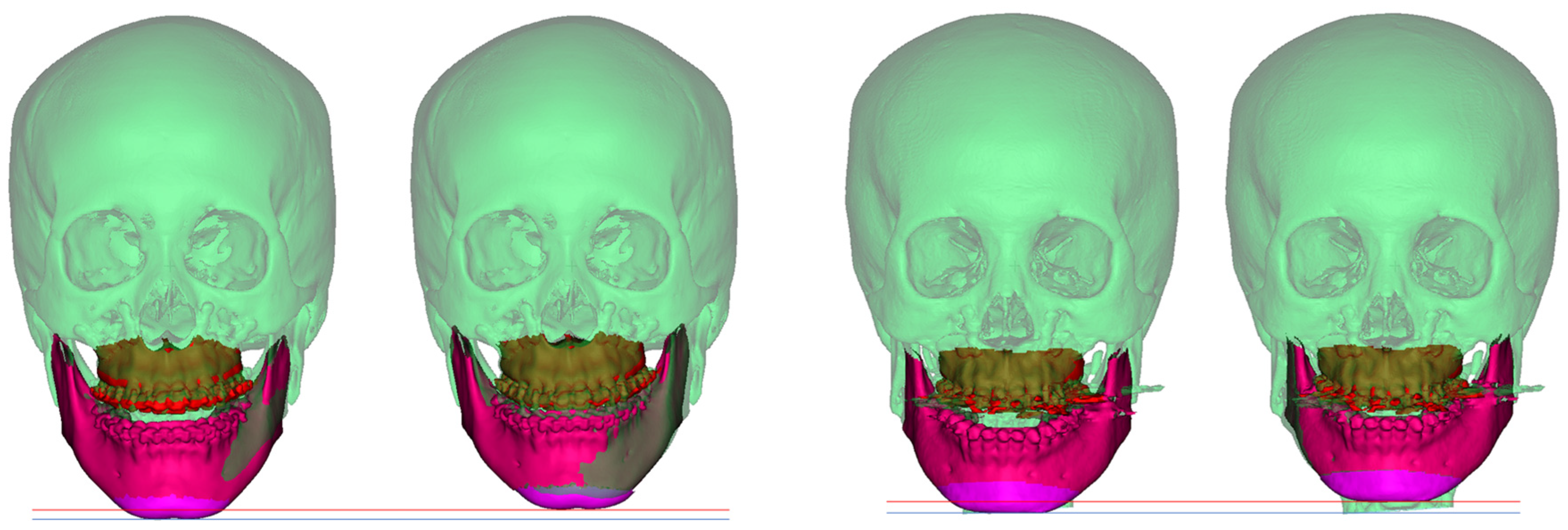 Jpm 12 00998 g004a 550