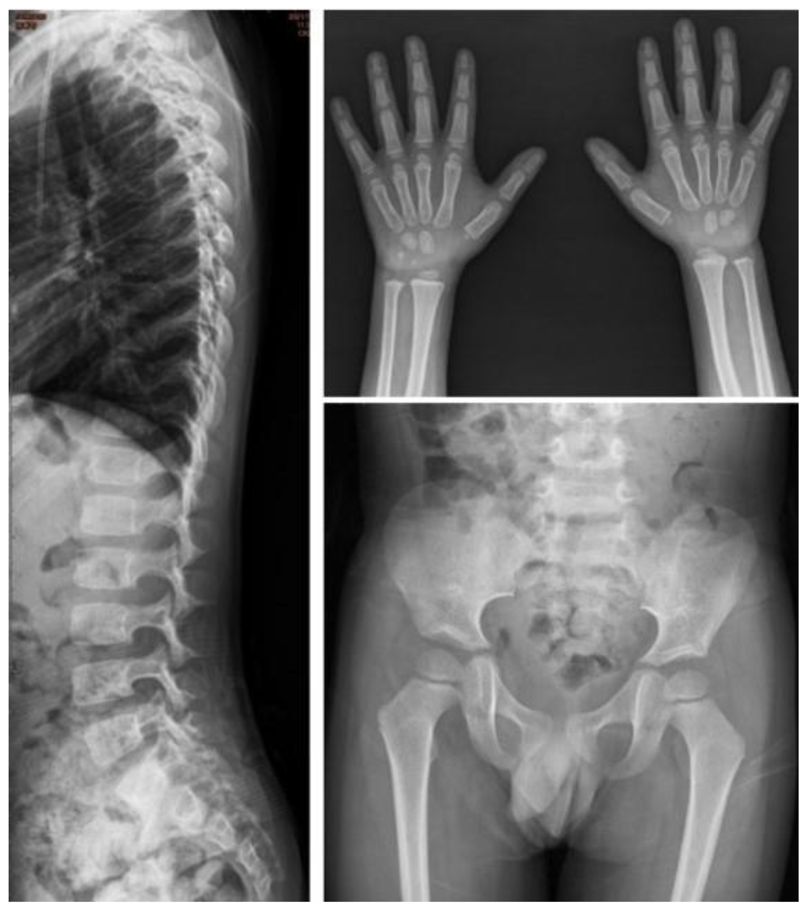 Jpm 12 01023 g005 Jpm 12 01023 g005