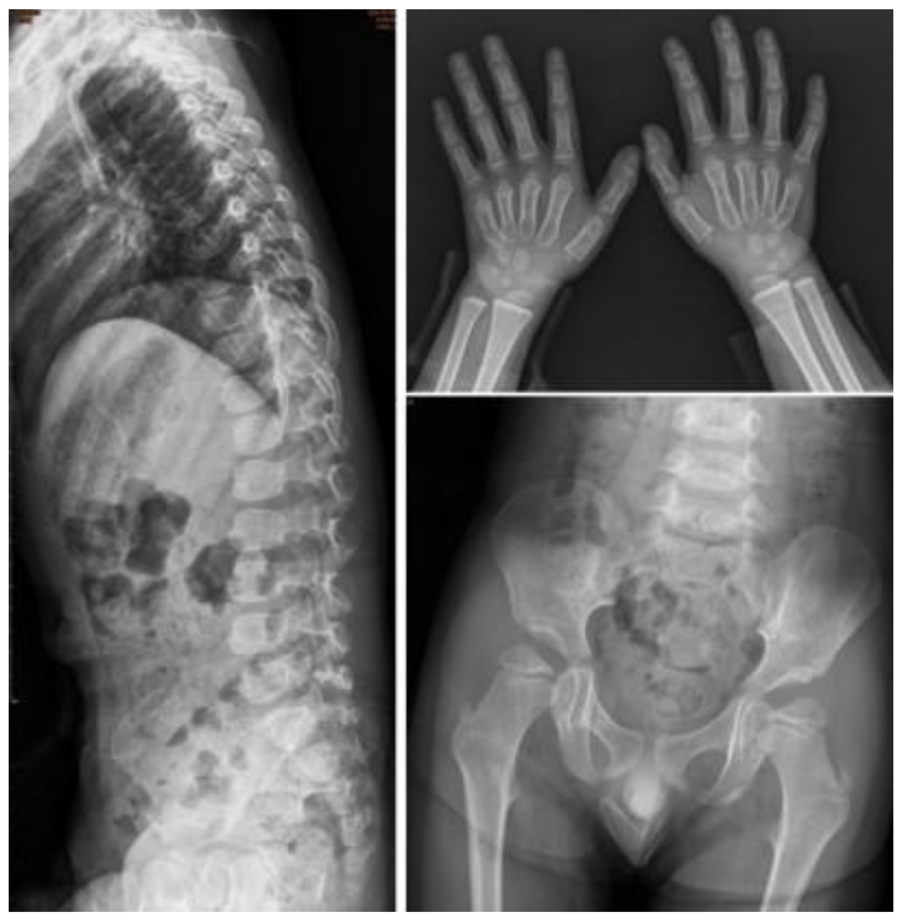 Jpm 12 01023 g006 Jpm 12 01023 g006