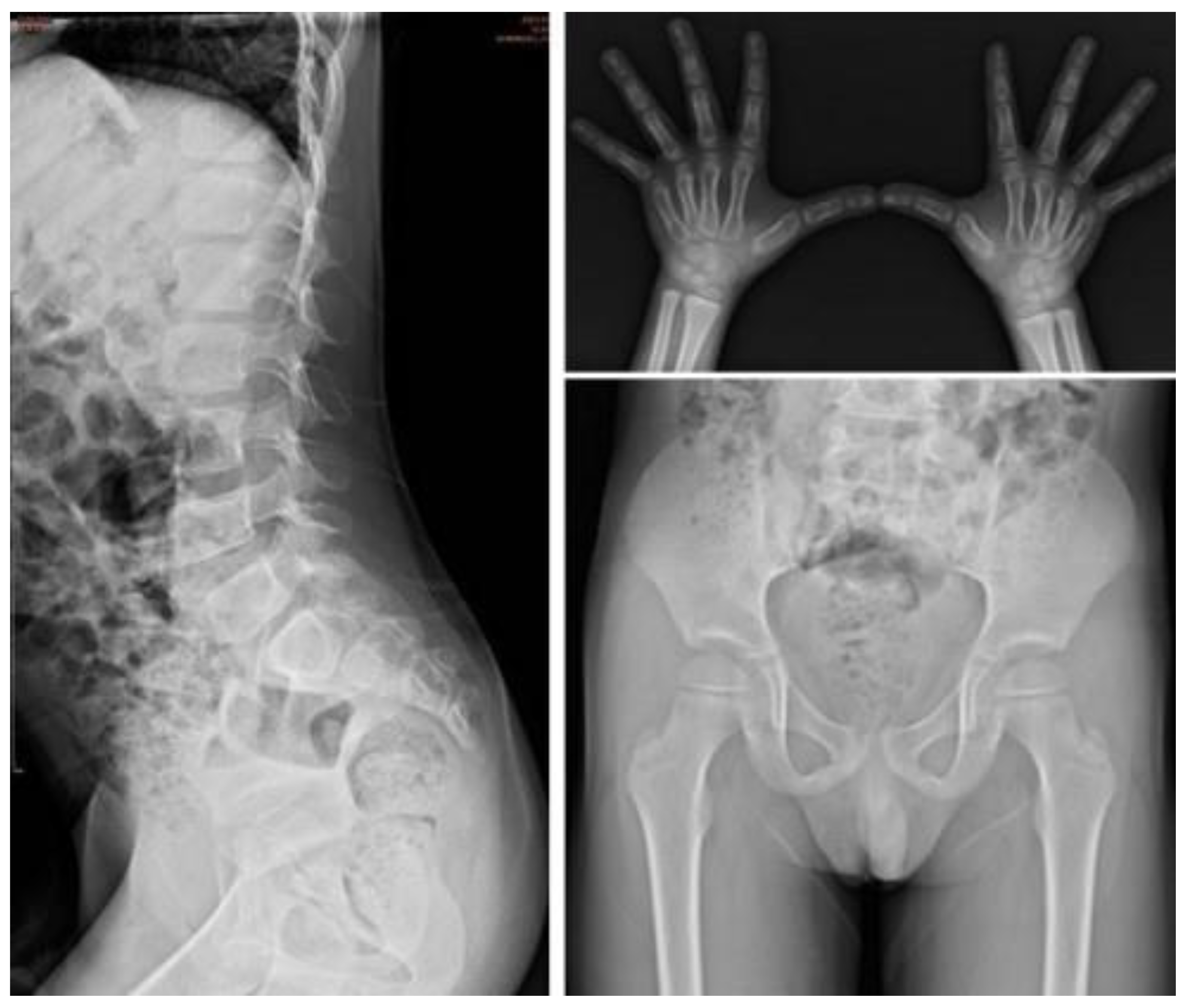 Jpm 12 01023 g008 Jpm 12 01023 g008