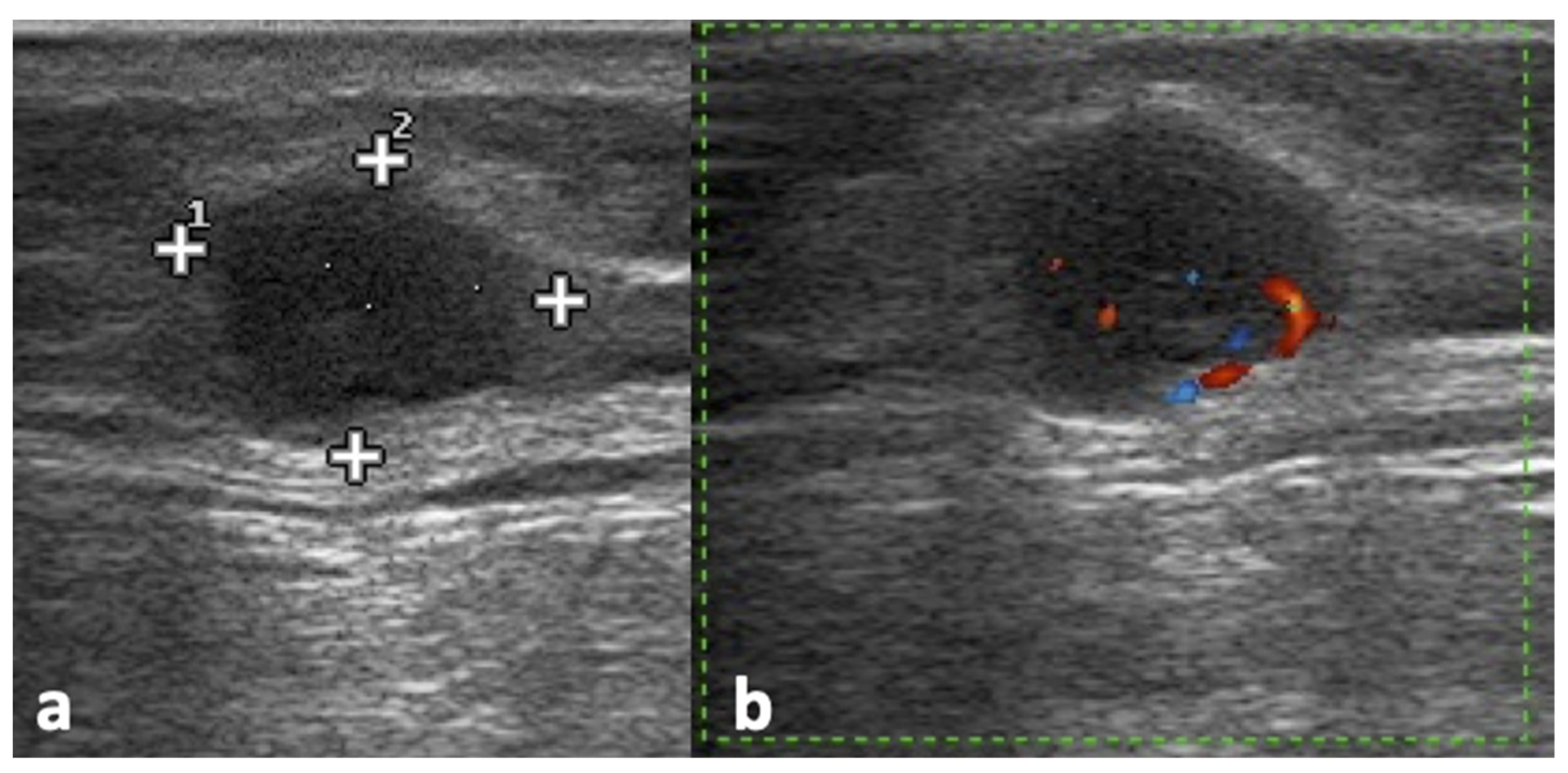 Jpm 12 01033 g002 Jpm 12 01033 g002