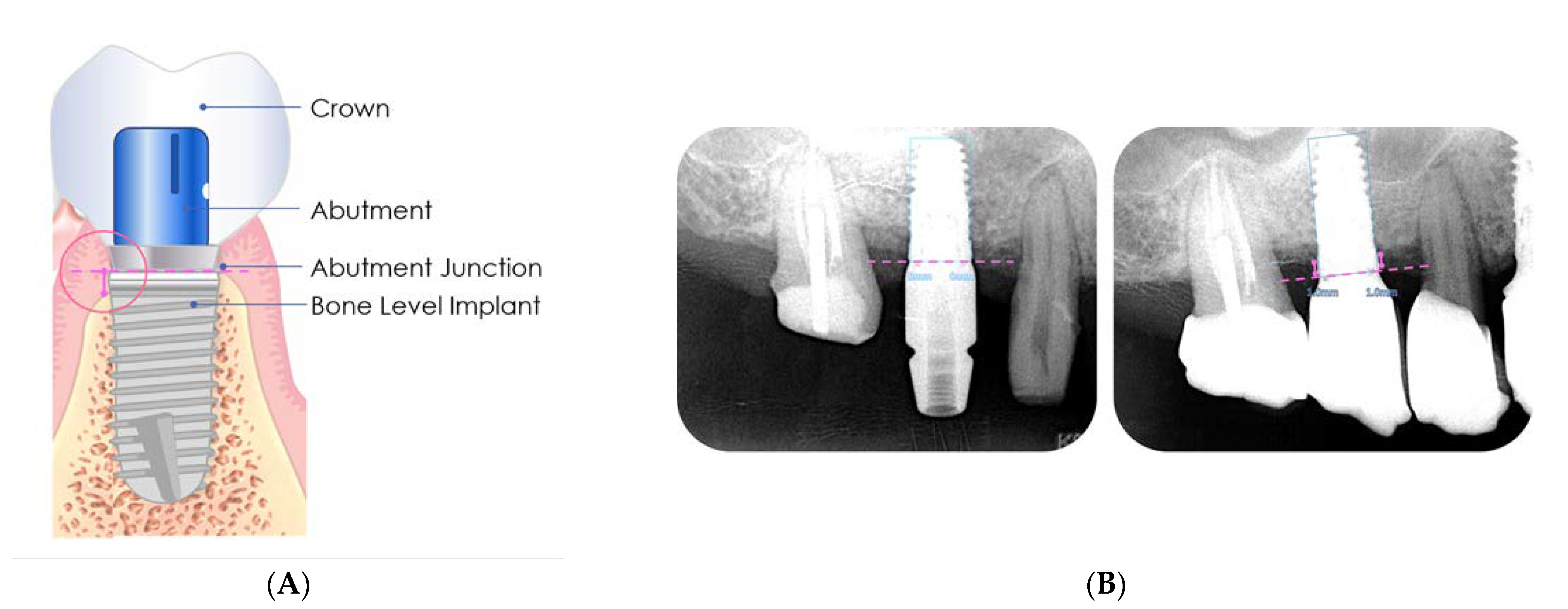 Jpm 12 01051 g002 550