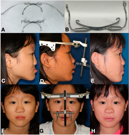 JPM Free FullText A Comparative Study of Skeletal and Dental