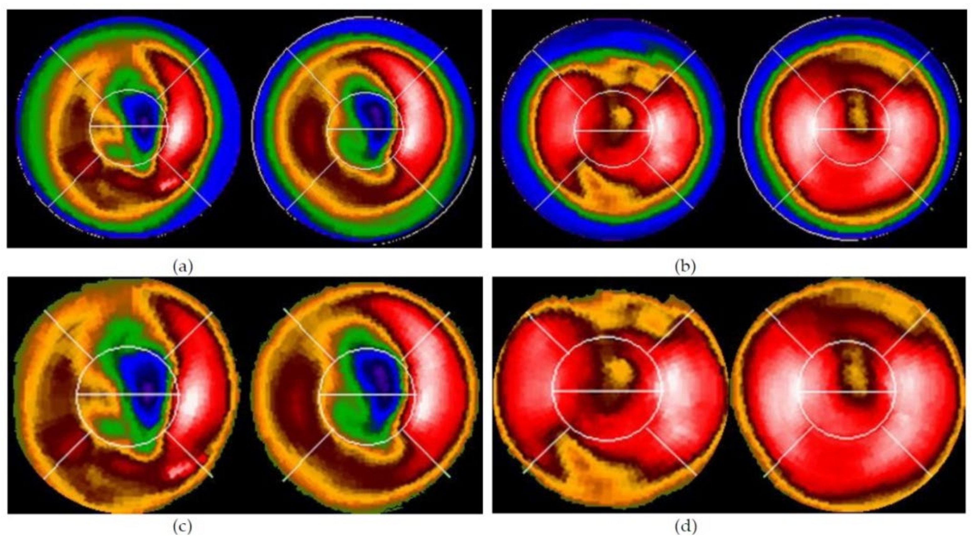 Jpm 12 01105 g004 550