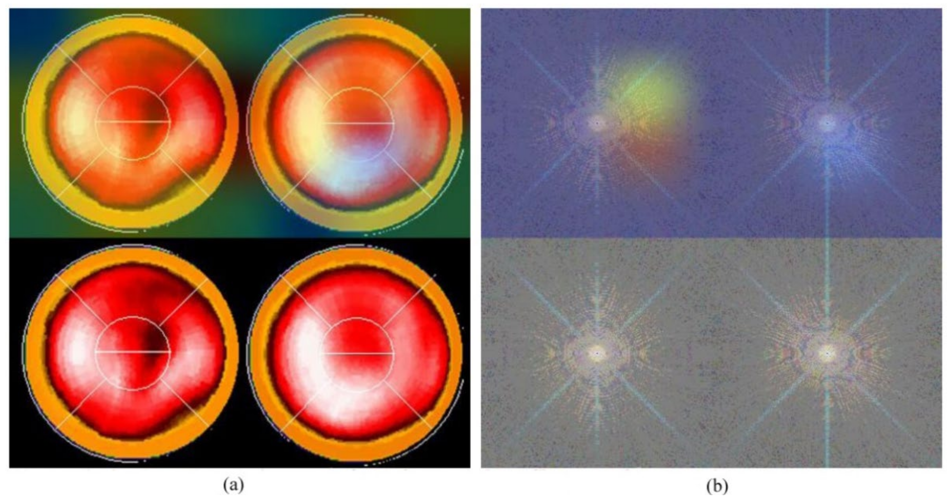 Jpm 12 01105 g005 550